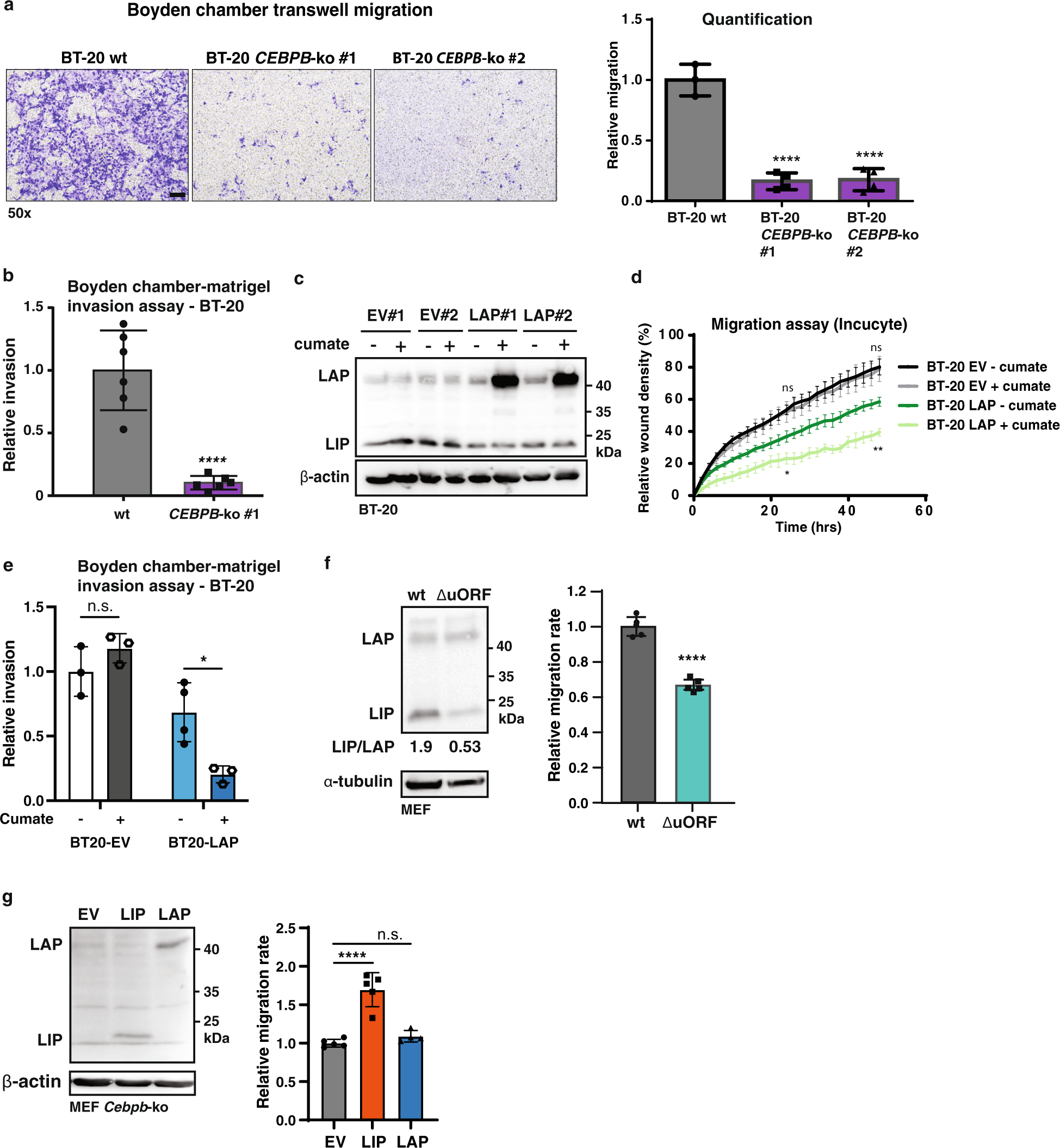 Fig. 3: LIP and LAP differentially regulate cell migration and invasion.