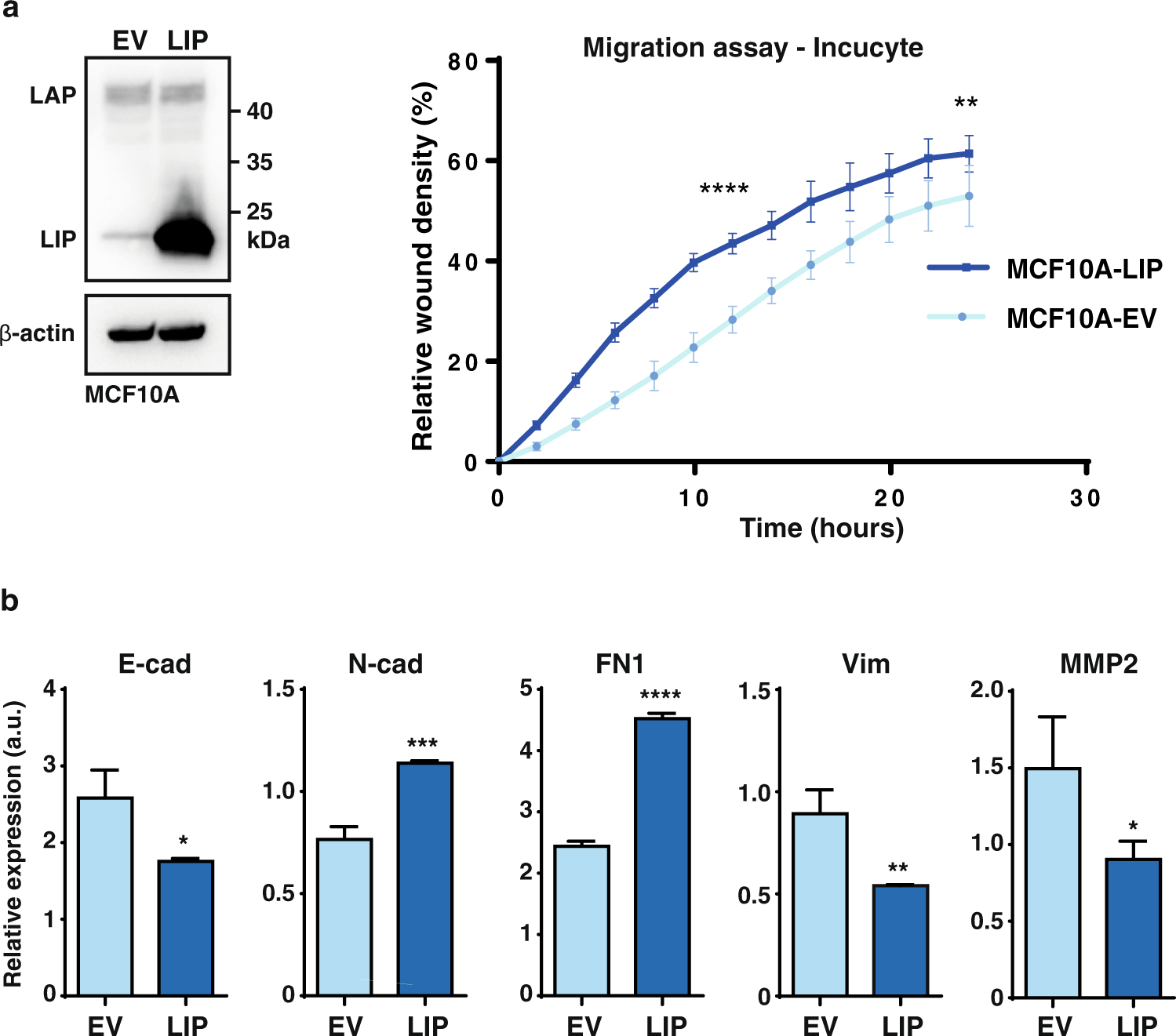 Fig. 4: C/EBPβ regulates a subset of EMT markers.