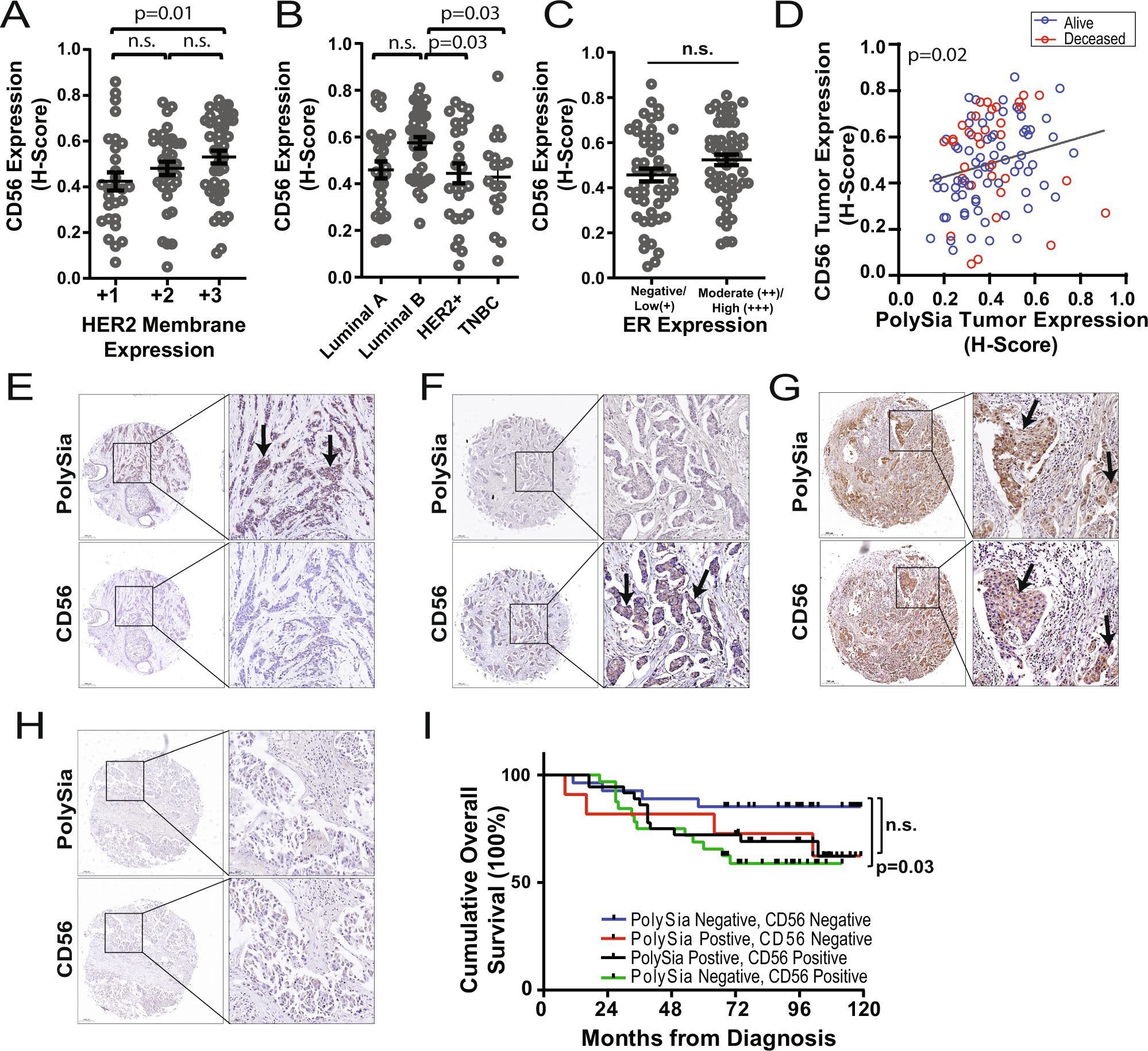 Fig. 6: PolySia and CD56 tumor cell expression in HER2 expressing tumors and correlation with patient outcomes.