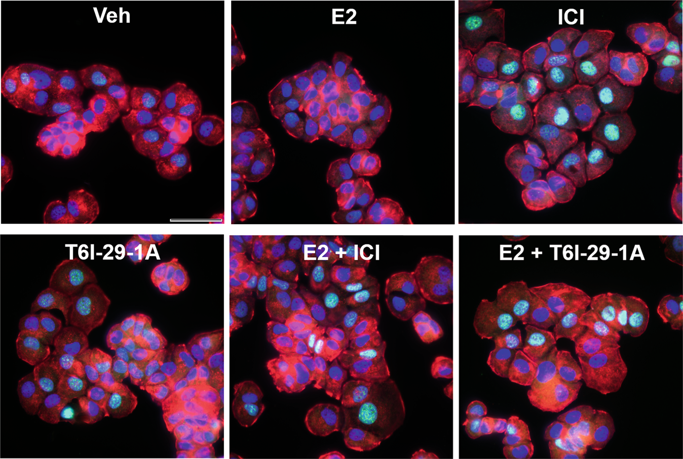 Fig. 11: ICI and T6I-29-1A enhance SUMO1 expression in T47D breast cancer cells.