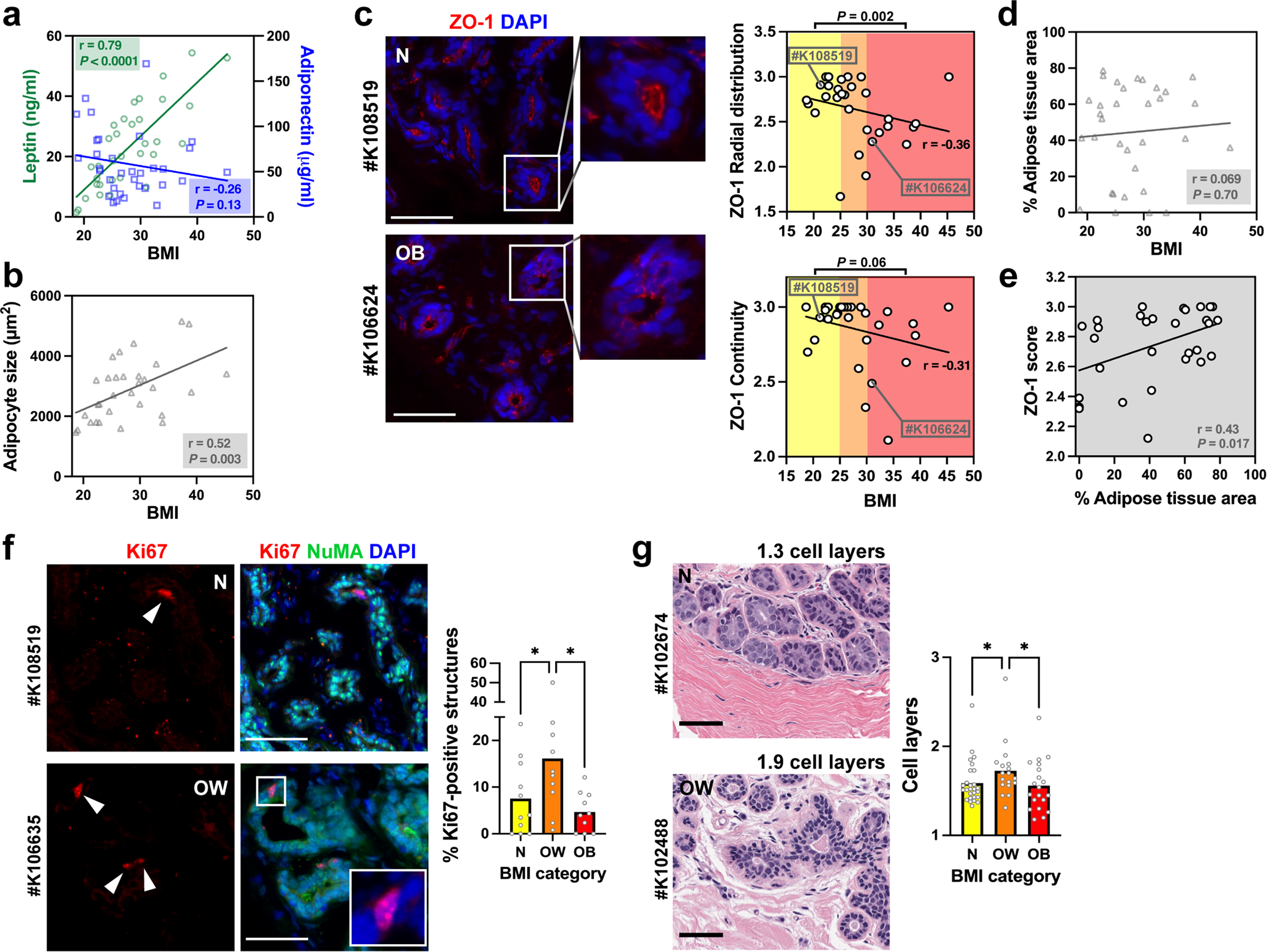 Breast cancer prevention by short-term inhibition of TGFβ