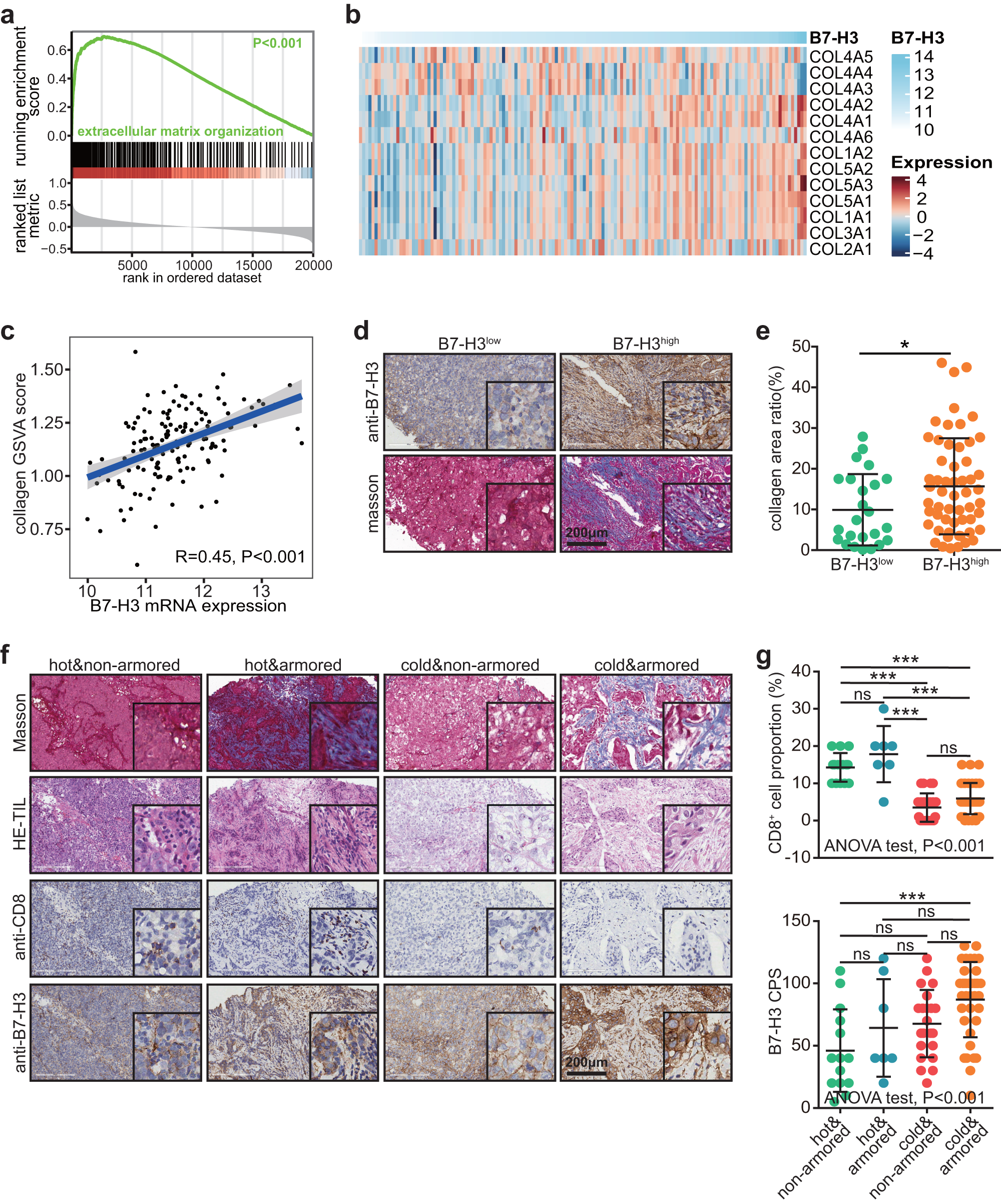 Fig. 2: Correlation between B7-H3 and collagen deposition in TNBC.