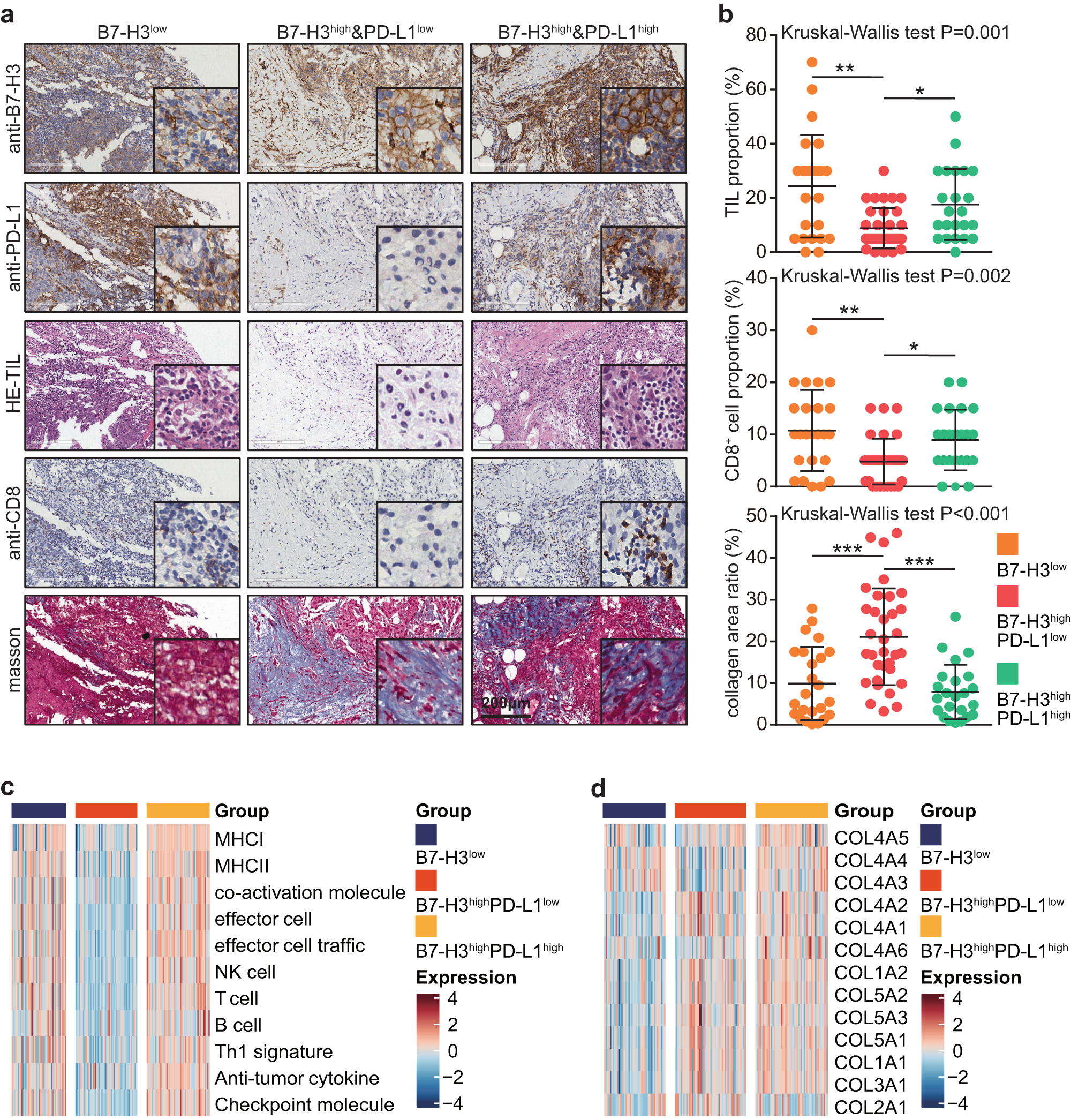 Fig. 4: TIME features of three subtypes divided by the combination of B7-H3/PD-L1.