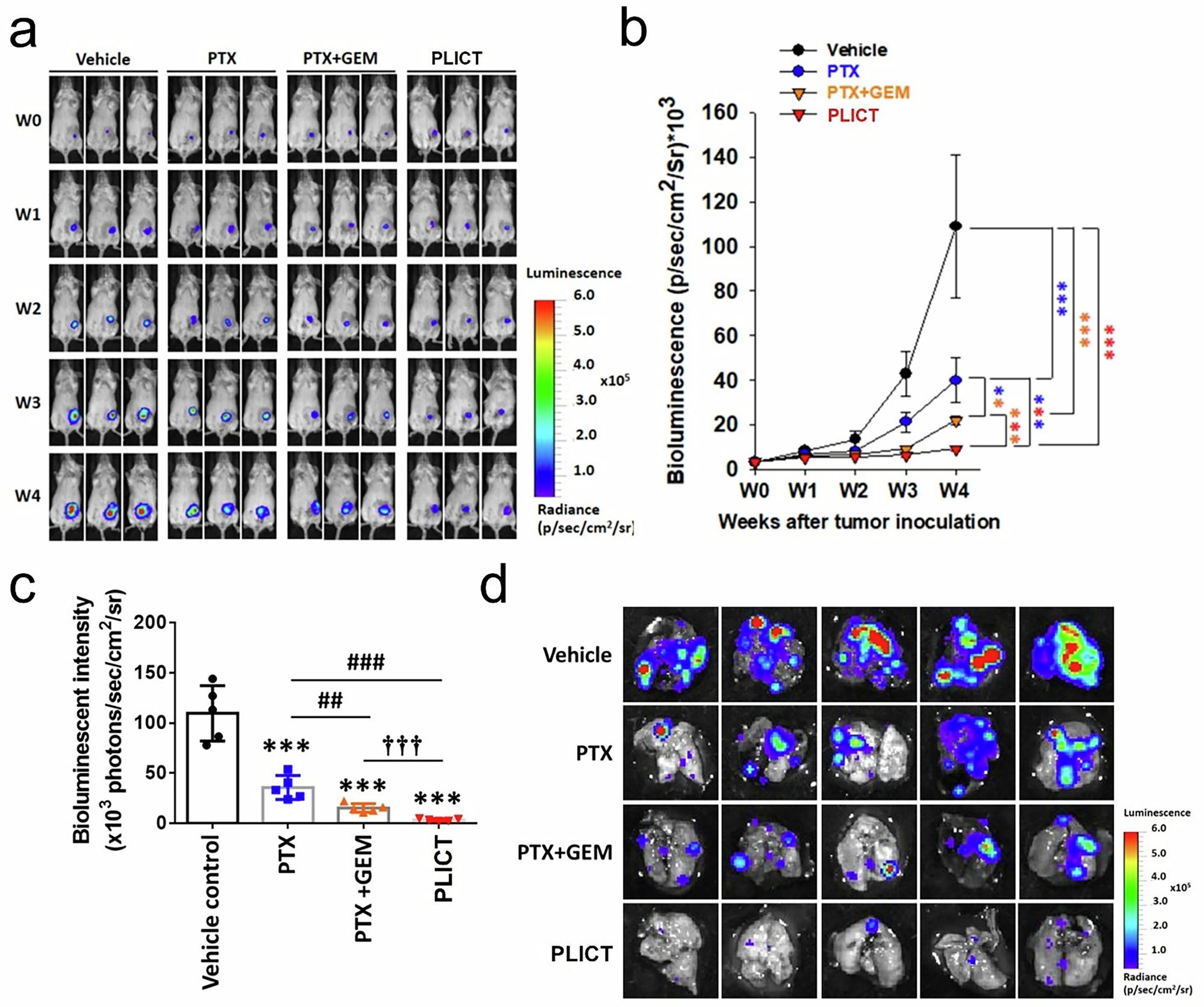 Fig. 6: Inhibition of tumor growth and metastasis by PLICT in an orthotopic TNBC mouse model.