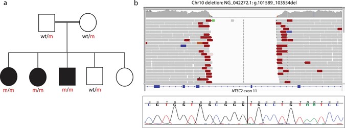 Whole Genome Sequencing Identifies New >> Whole Genome Sequencing Identifies A Novel Homozygous Exon Deletion Whole Genome Sequencing Identifies New >> Whole Genome Sequencing Identifies A Novel Homozygous Exon Deletion