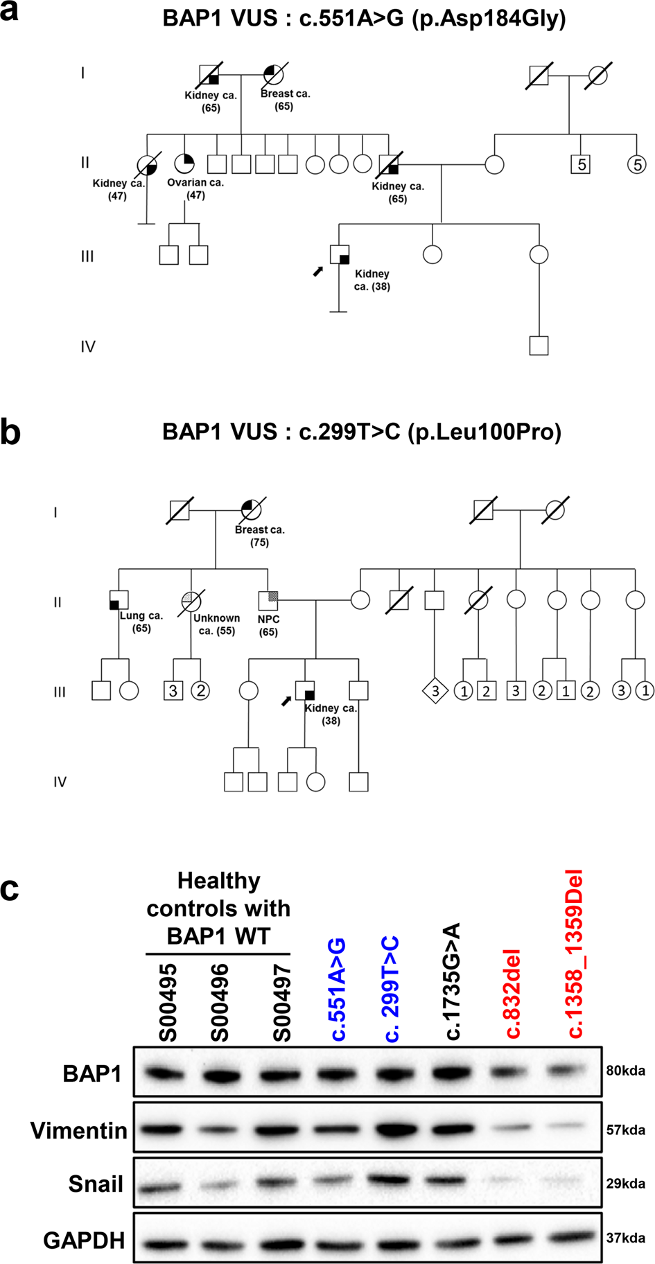 Functional Characterisation Guides Classification Of Novel Bap1 Germline Variants Npj Genomic Medicine Functional Characterisation Guides Classification Of Novel Bap1 Germline Variants Npj Genomic Medicine