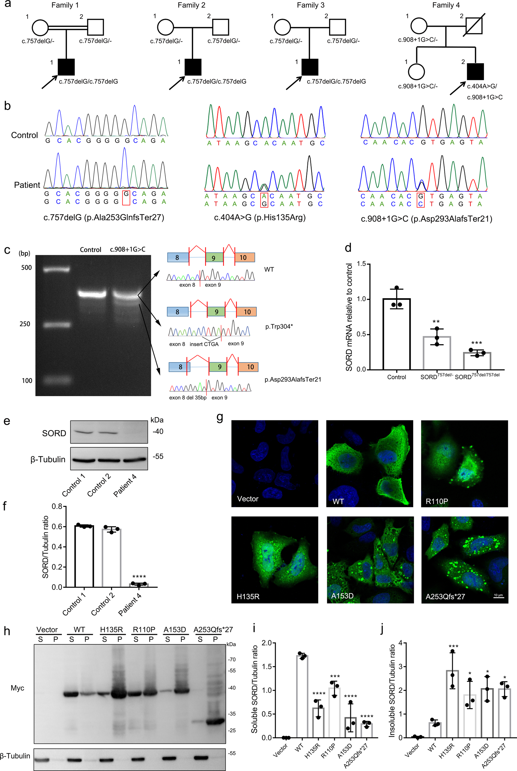 Fig. 1: Genetic and functional findings in dHMN patients with SORD variants.