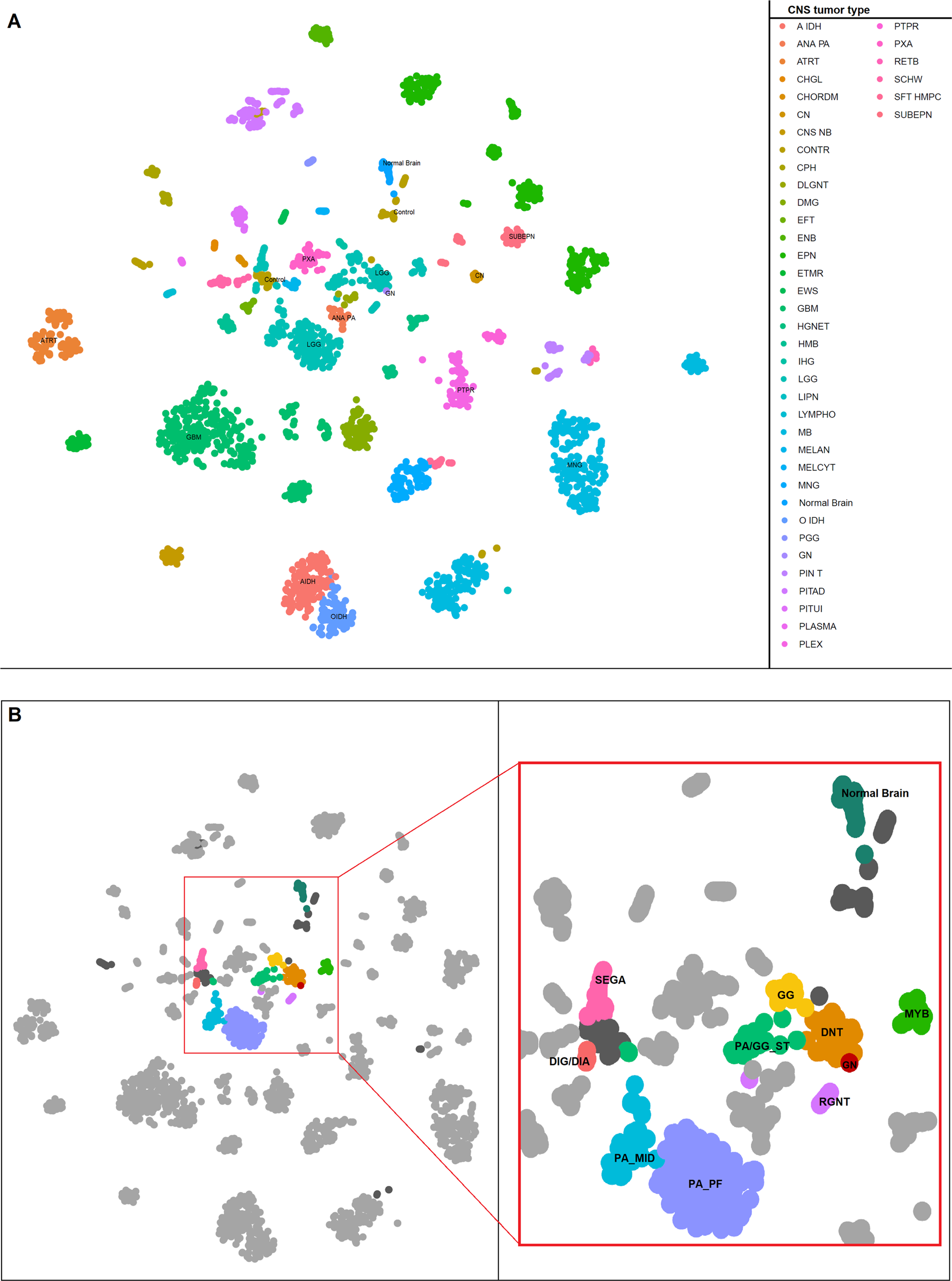 Fig. 2: t-SNE map showing the categorization of the glioneuronal tumor (GNT) and normal brain samples with public CNS tumor data.