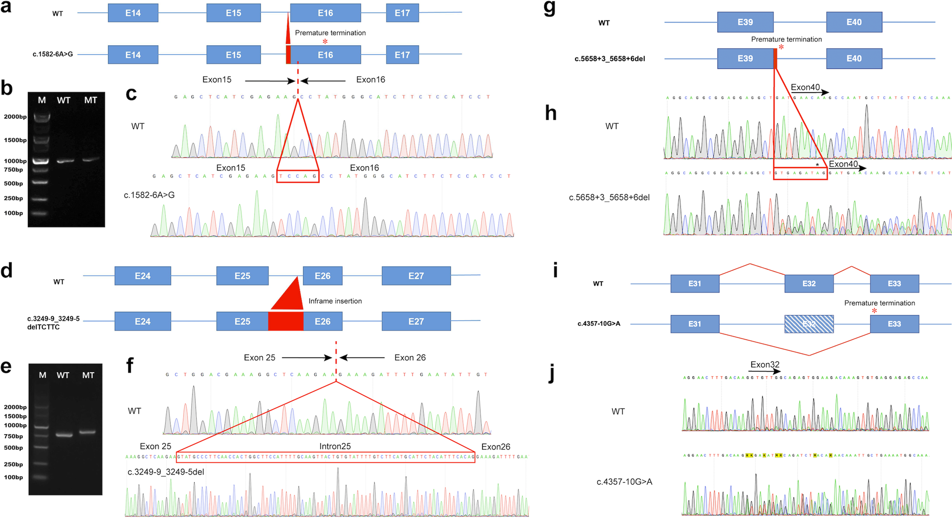 Fig. 5: Analysis of the MYH3 splicing abnormalities in families D, E, F, and J.