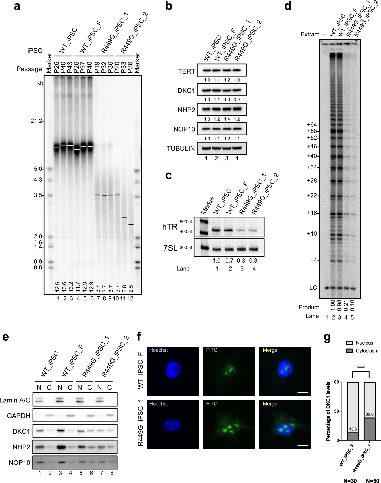 Fig. 5: DKC1_R449G iPSCs exhibit a shorter telomere length, decreased levels of hTR, reduced telomerase activity, and mislocalized DKC1.