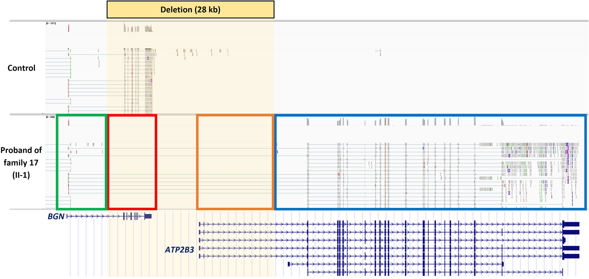 Fig. 3: mRNA sequencing of skin fibroblasts of the proband from family 17 (17-II-1) shows BGN 5’-UTR hijacking by ATP2B3.