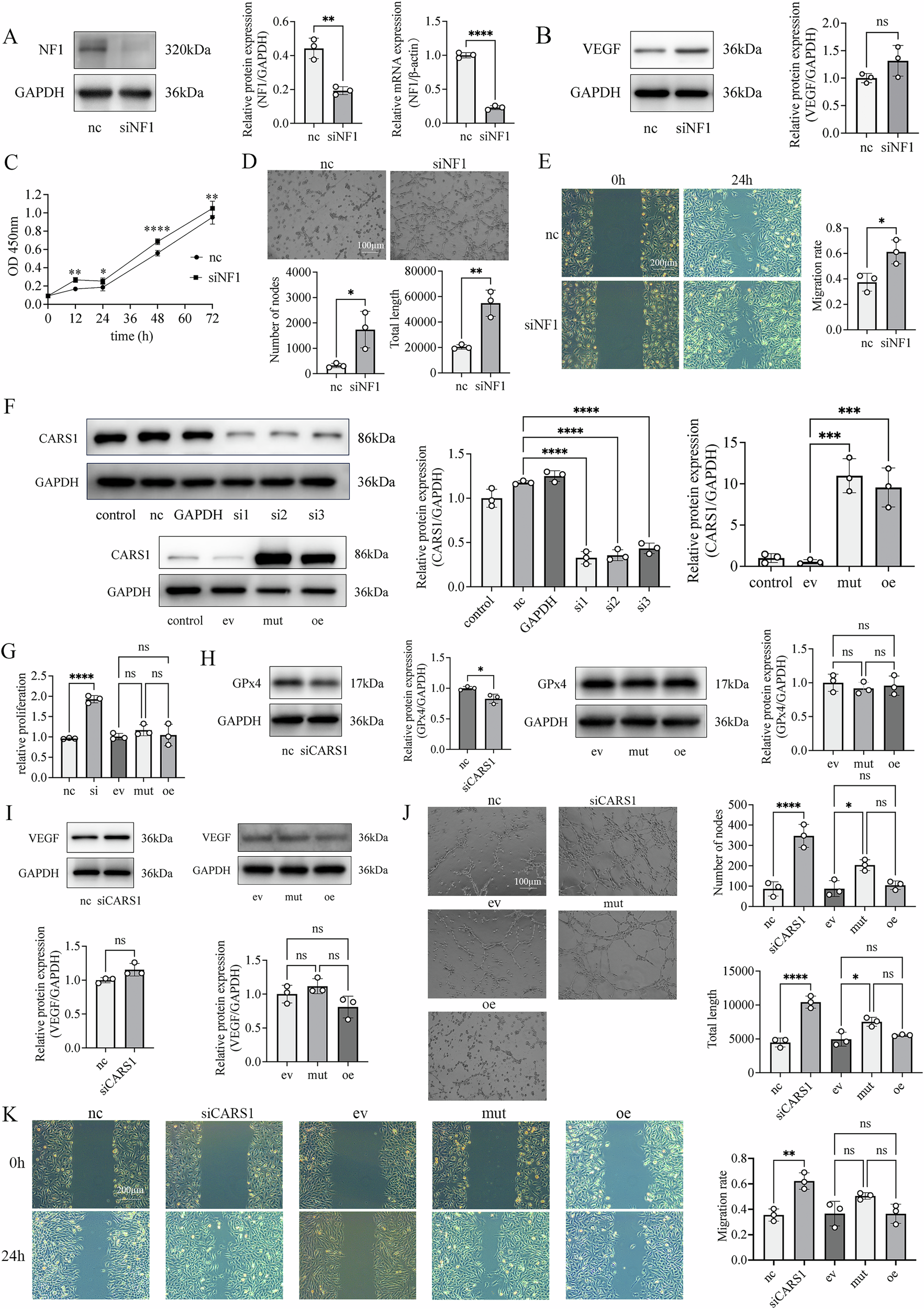 Fig. 3: NF1 and CARS1 promote angiogenesis in human brain microvascular endothelial cells (HBMECs).