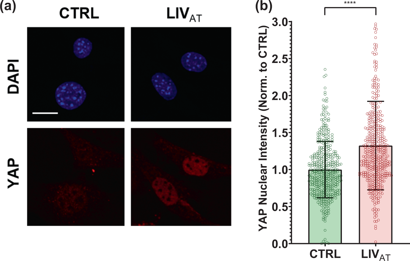 Low Intensity Vibration Restores Nuclear Yap Levels And Acute Yap Nuclear Shuttling In Mesenchymal Stem Cells Subjected To Simulated Microgravity Npj Microgravity