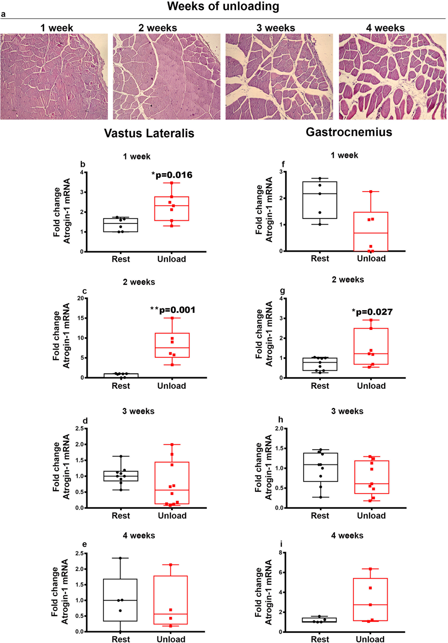 Fig. 1: Effect of unloading on muscle morphology and Atrogin-1 mRNA expression in Vastus Lateralis and Gastrocnemius.
