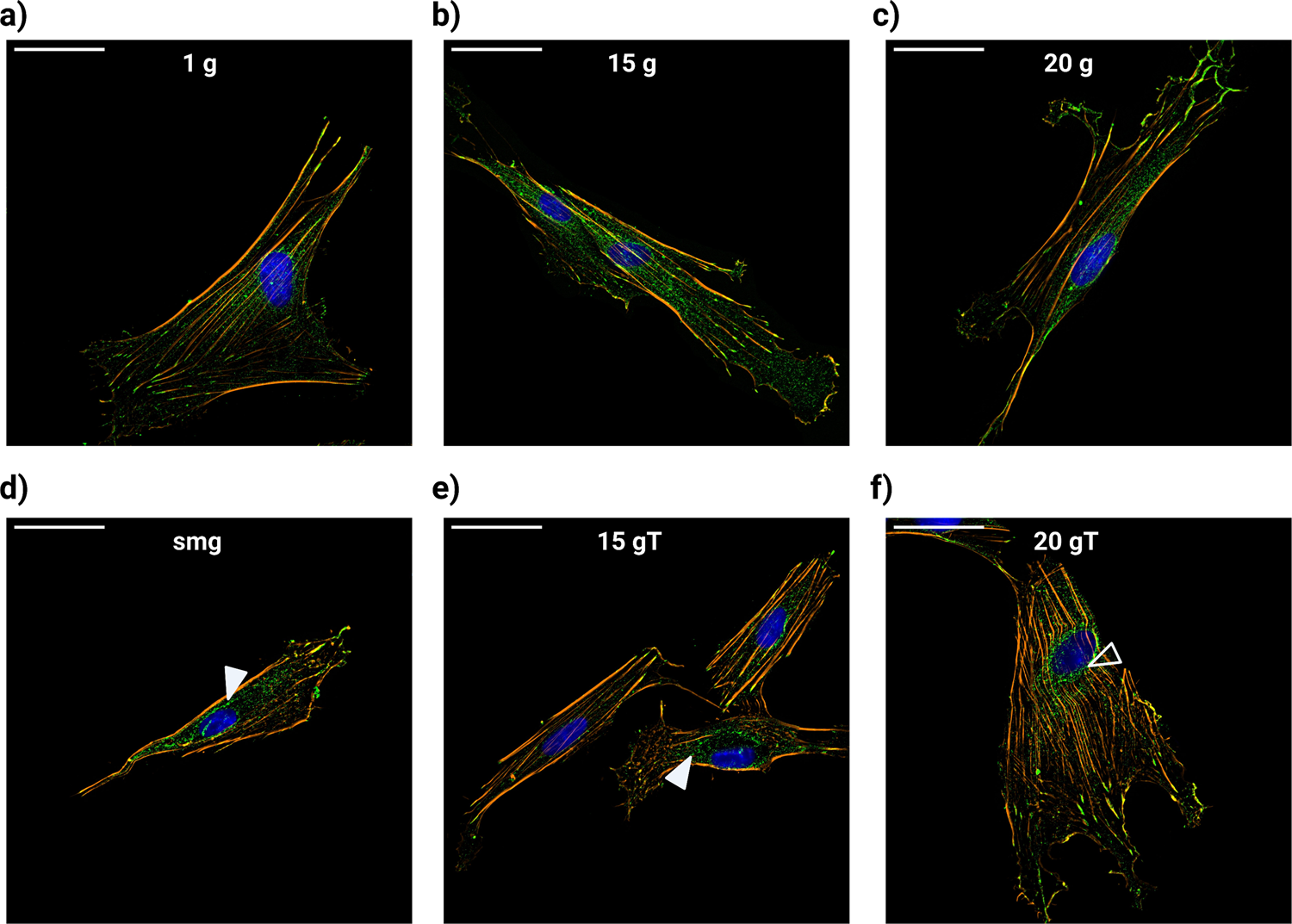 Fig. 4: Immunofluorescence staining of phalloidin for actin structures (orange), vinculin for focal adhesions (green), and DAPI for cell nucleus (blue).
