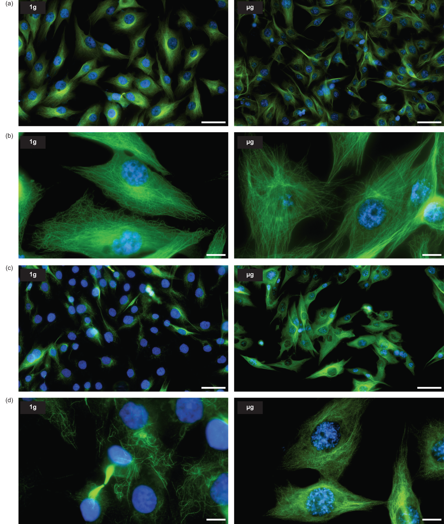 Fig. 4: α-Tubulin and acetyl-α-tubulin architecture in 1 g flight control and µg cells.