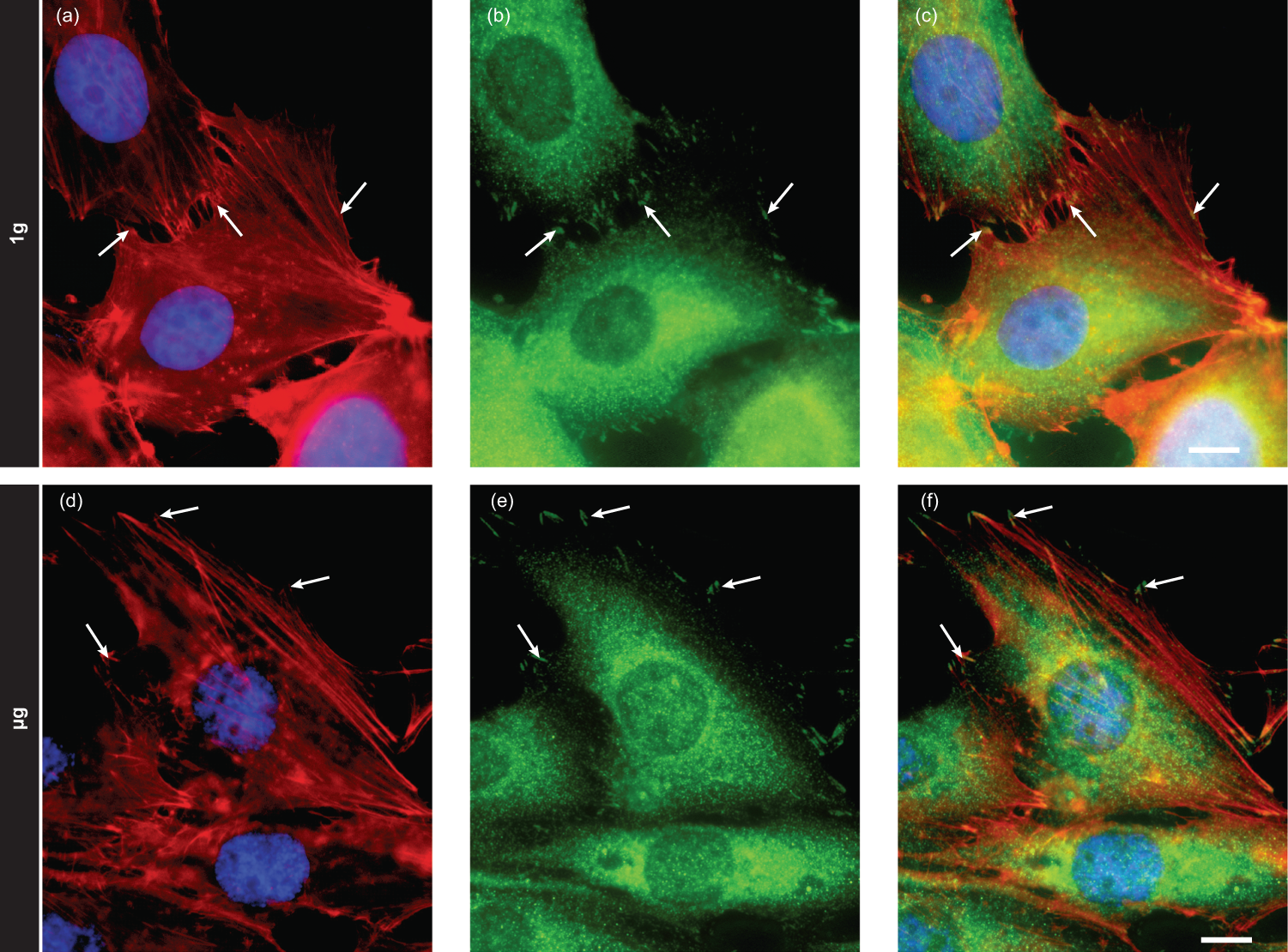 Fig. 6: Fibrillar actin and pFAK staining in 1 g flight control and µg cells.