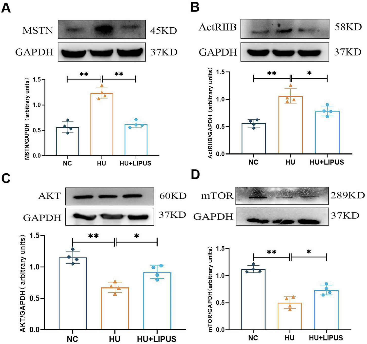 Fig. 2: The effect of abdominal ultrasound on the MSTN/AKT/mTOR signaling pathway in hindlimb unloaded mice.