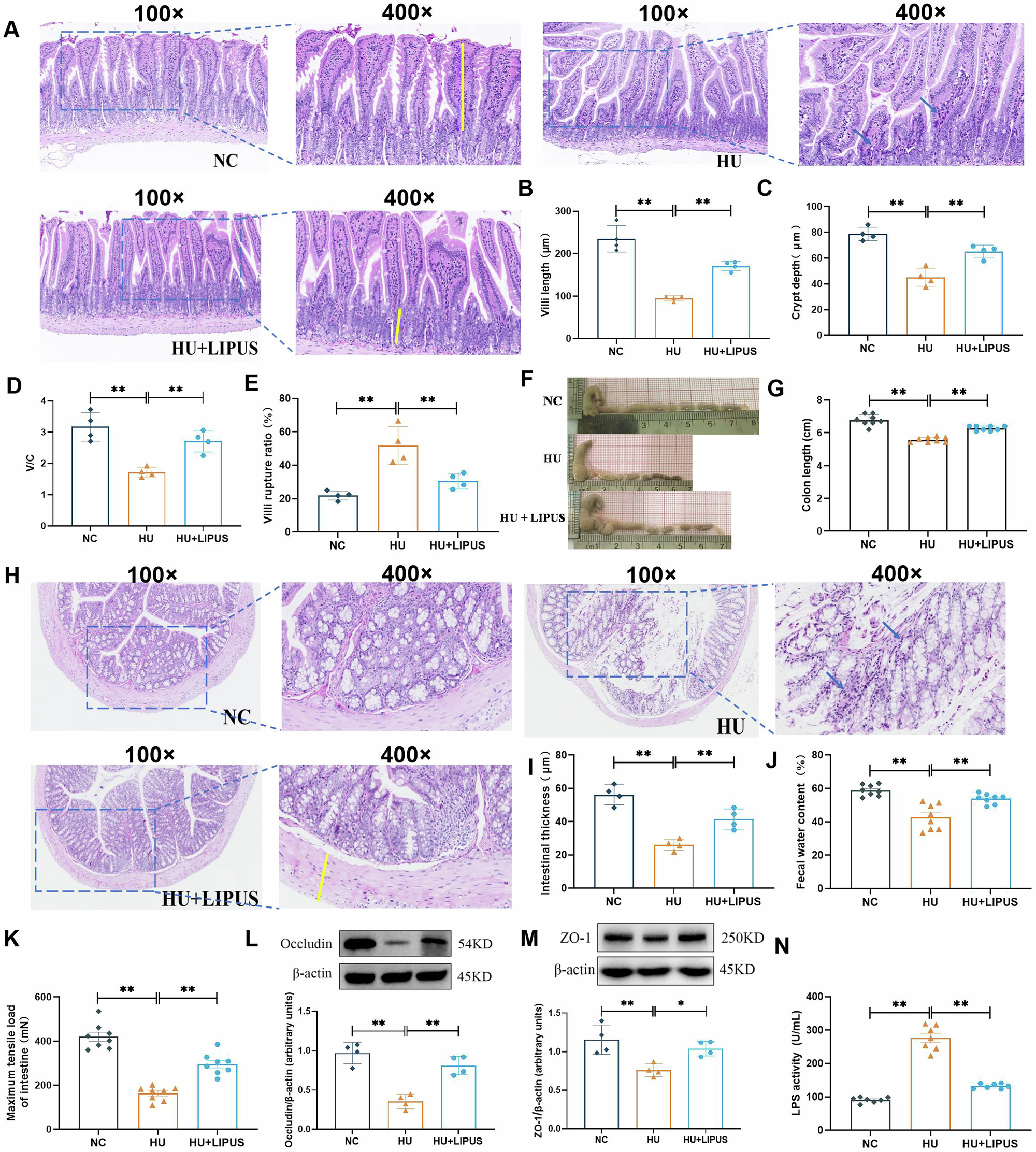 Fig. 3: The effect of abdominal LIPUS treatment on intestinal barrier and function in hindlimb unloaded mice.