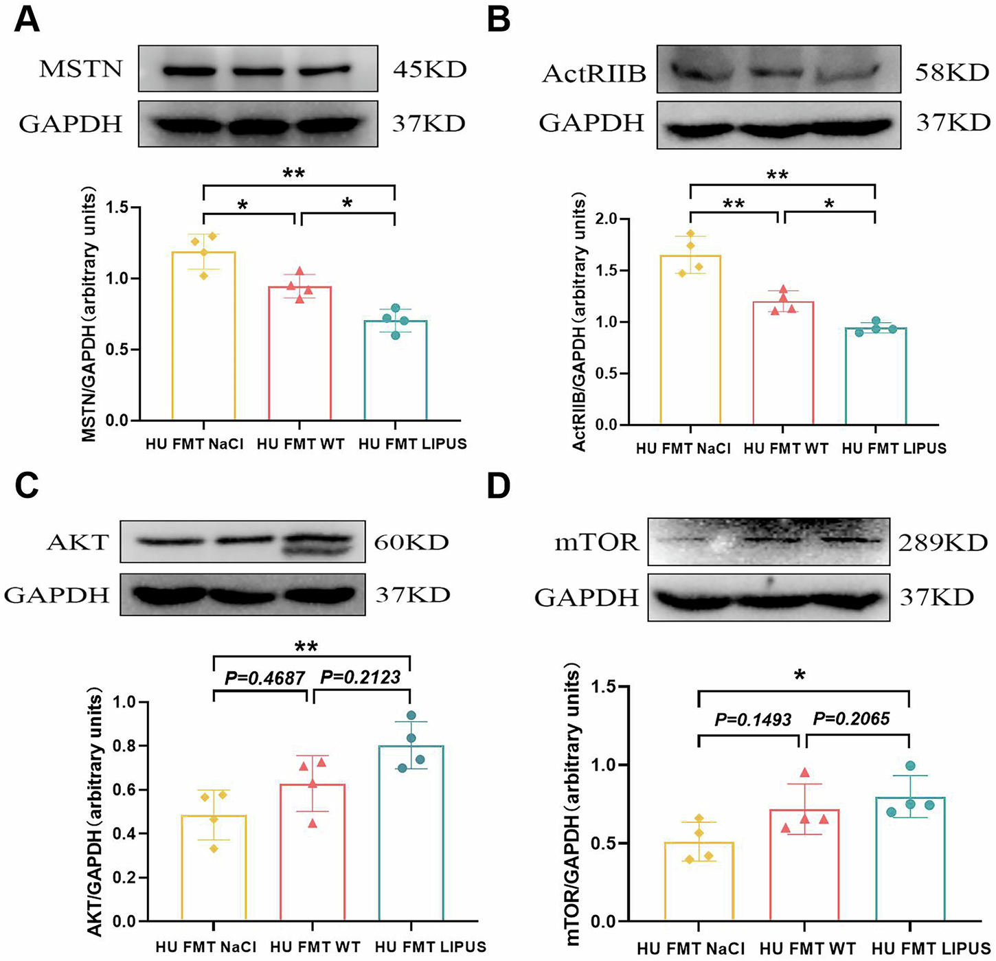 Fig. 8: The effect of fecal microbiota transplantation from abdominal LIPUS treated mice on the MSTN/AKT/mTOR signaling pathway in hindlimb unloaded mice.