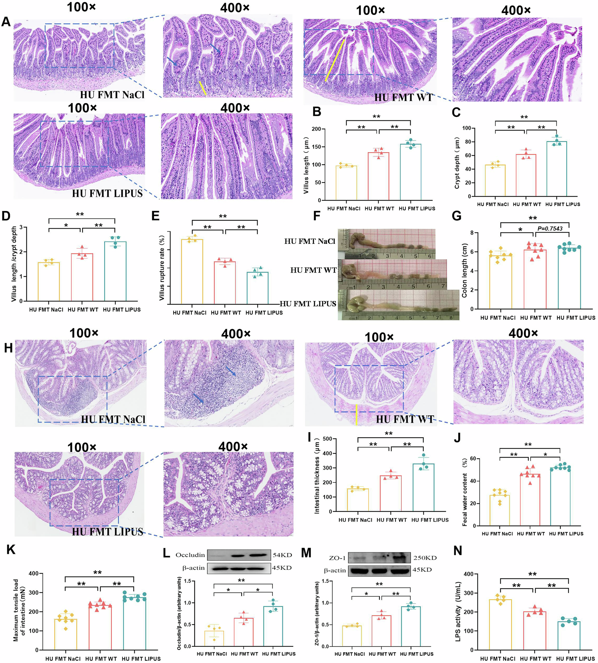 Fig. 9: The effect of fecal microbiota transplantation from abdominal LIPUS treated mice on intestinal barrier and function in hindlimb unloaded mice.