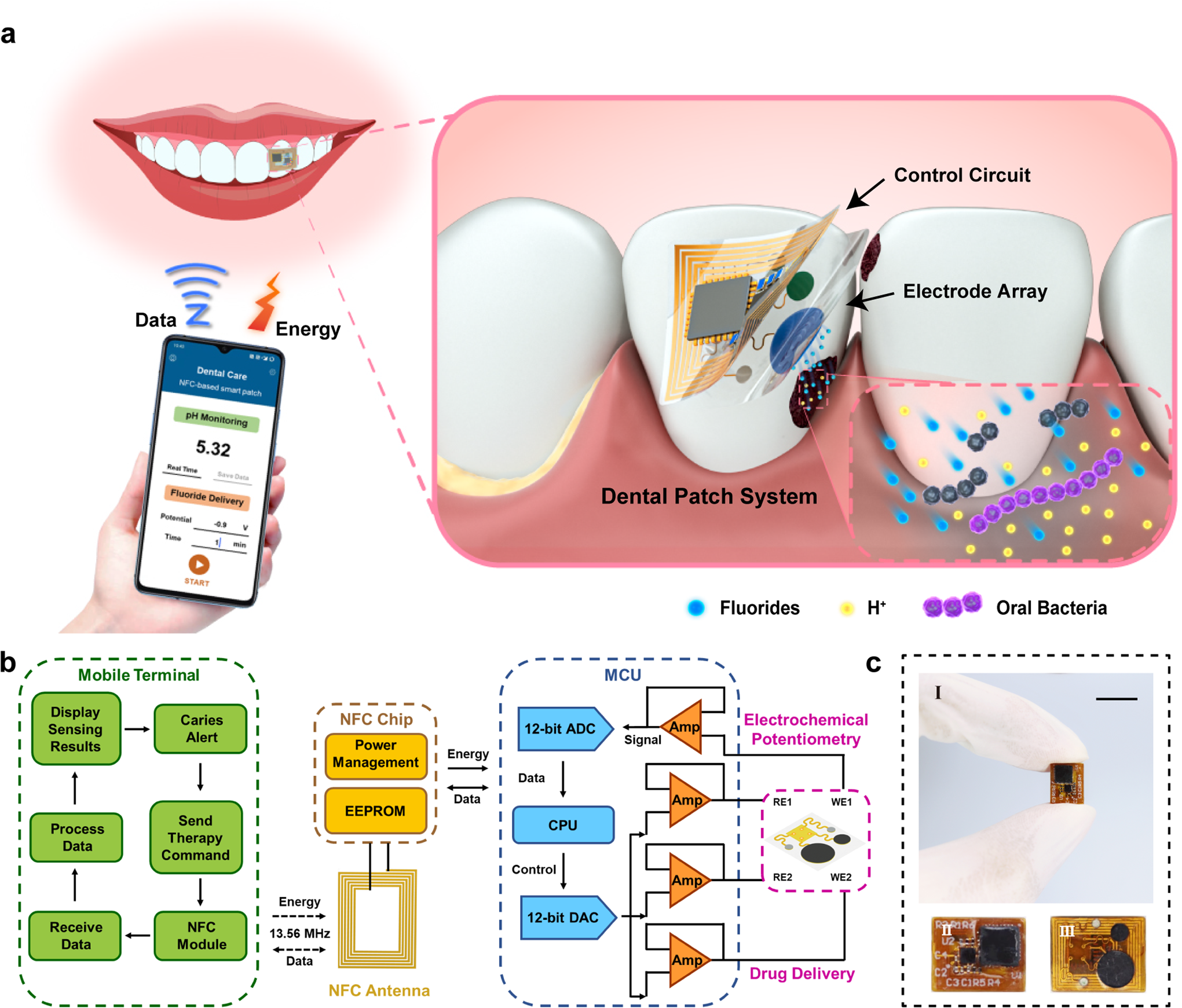 Wearable battery-free theranostic dental patch for wireless intraoral  sensing and drug delivery | npj Flexible Electronics