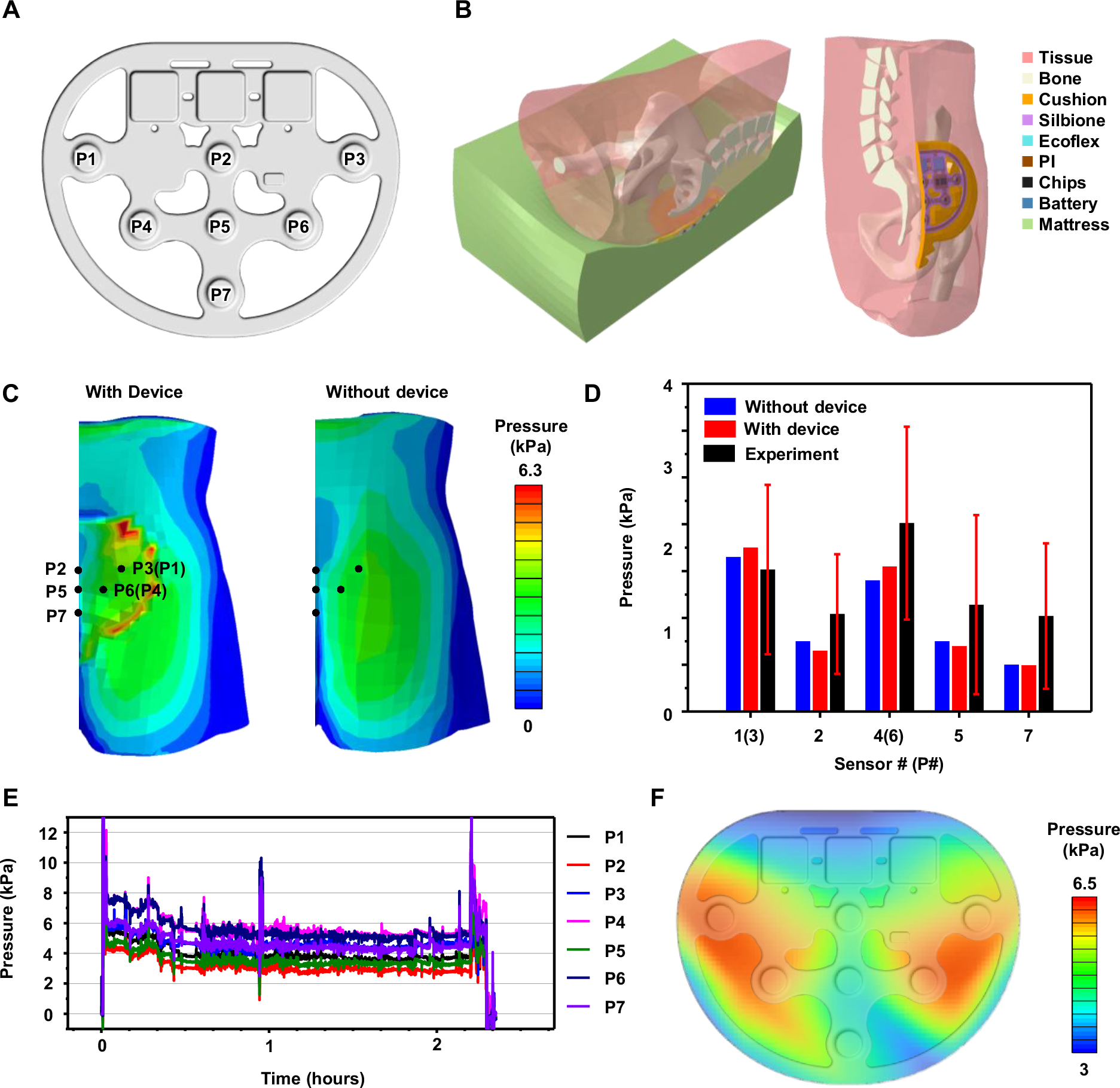 Fig. 3: Pressure distribution on the skin interface at the sacrum.