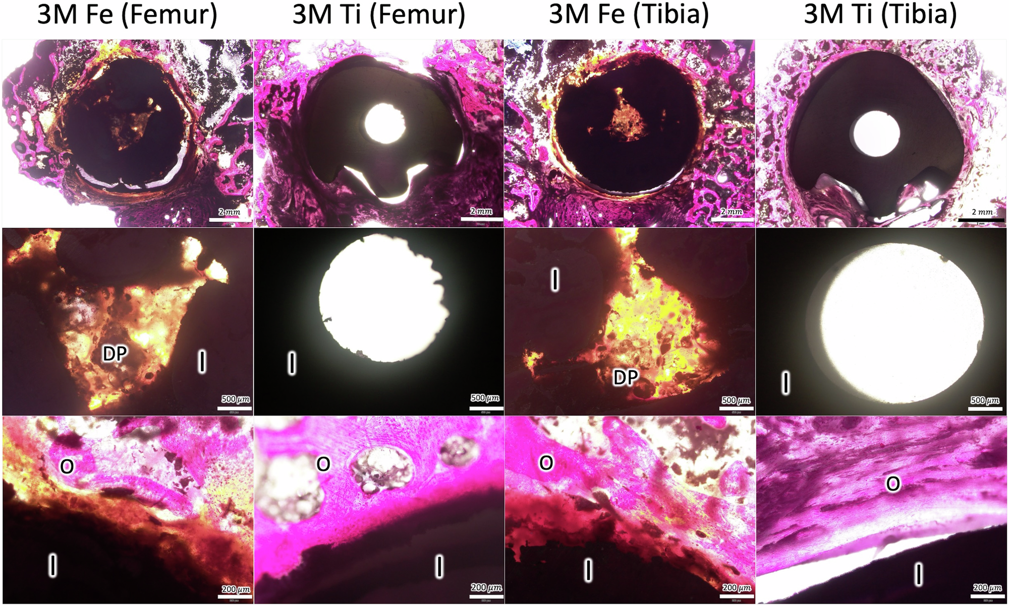 Fig. 2: Histological examination of bone and interference screws stained with Sanderson’s rapid bone stain located in the porcine femur and tibia at 3 months post-operation.