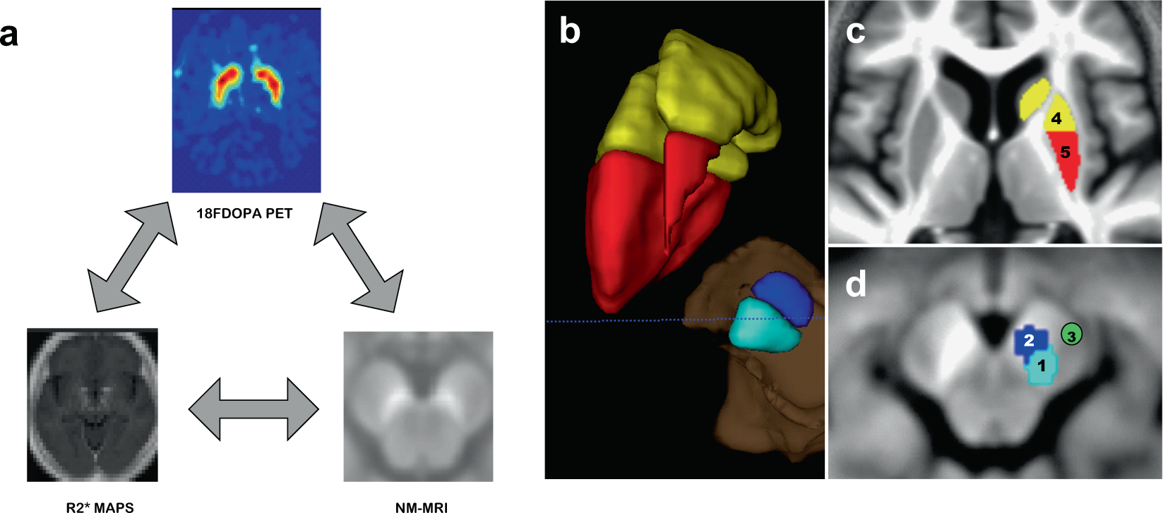 Imaging biomarkers in Parkinson's disease and Parkinsonian