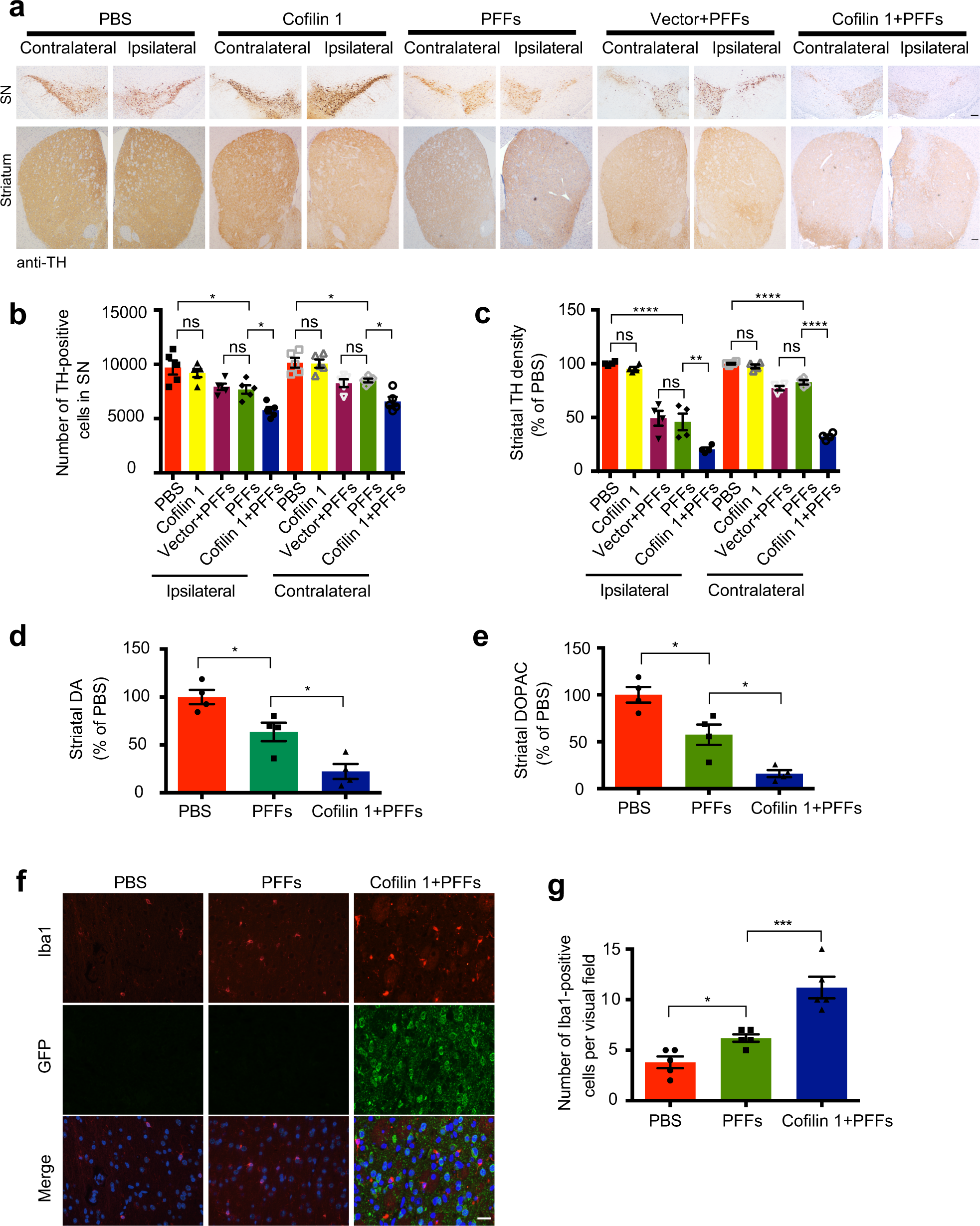 Fig. 5: Cofilin 1 promotes the degeneration of dopaminergic neurons induced by α-synuclein fibrils in vivo.