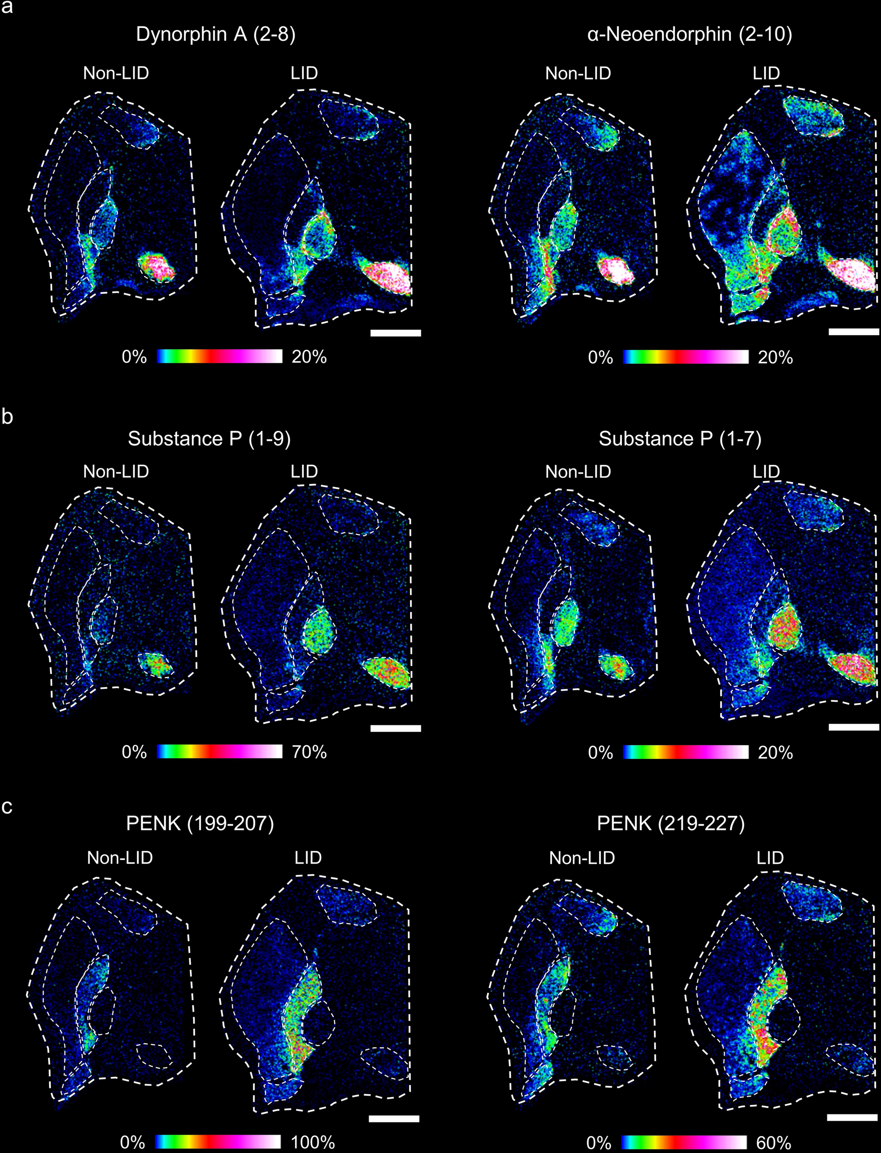 Fig. 3: Processed fragments of active neuropeptides elevated in LID.