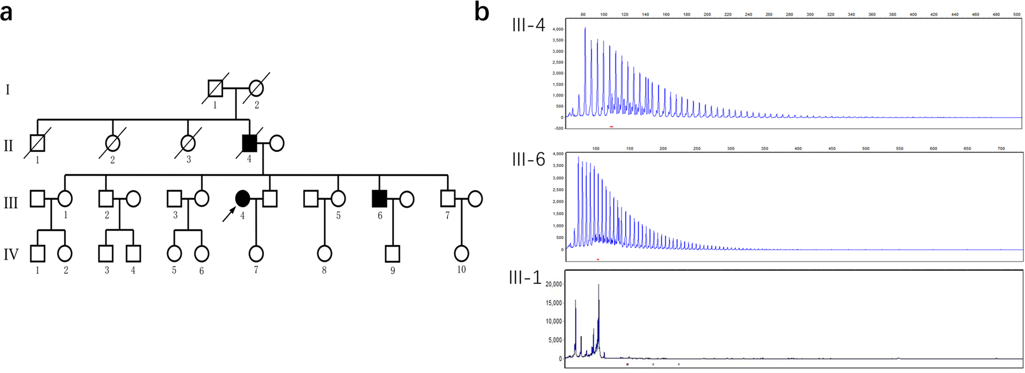 Fig. 1: FTDP pedigree with C9ORF72 repeat expansions.