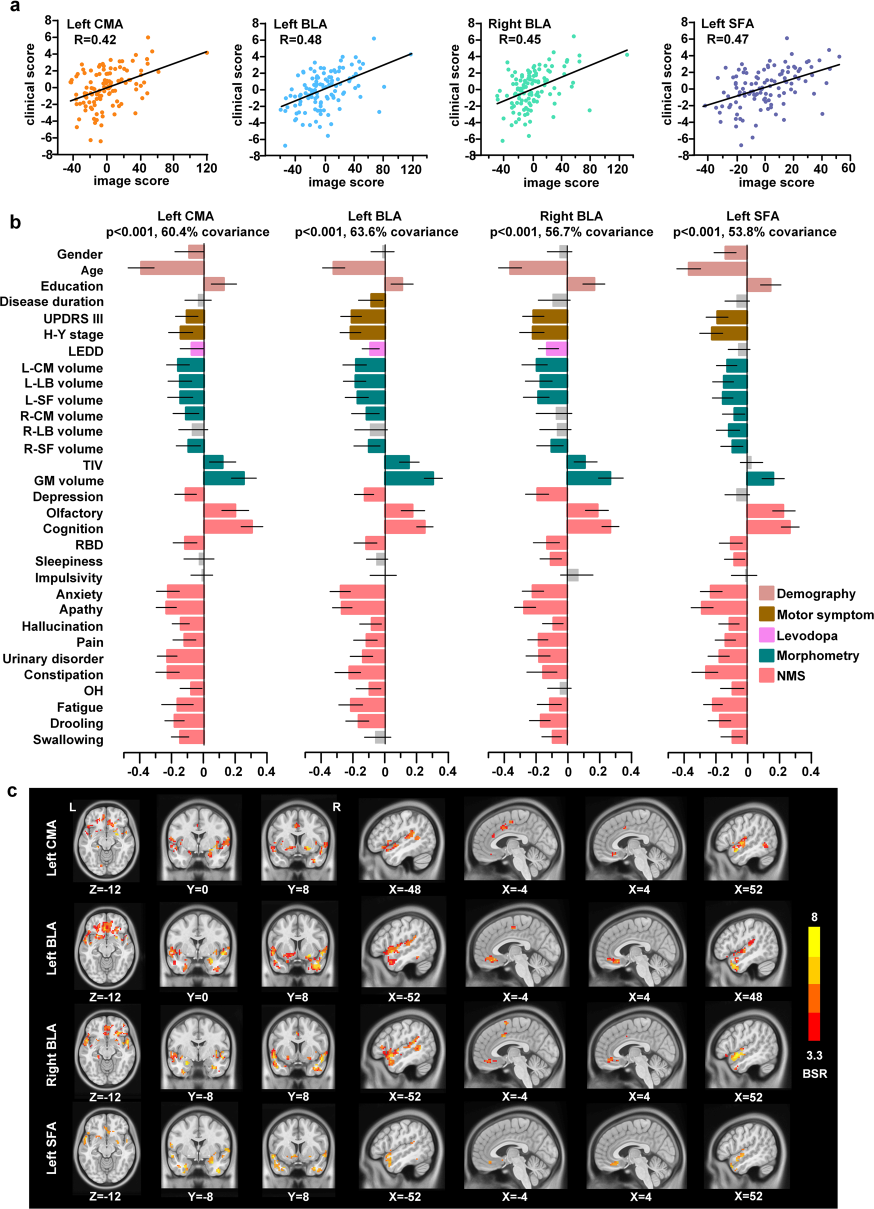 Fig. 3: Amygdala subregion-specific comprehensive clinical-functional signatures in PD.