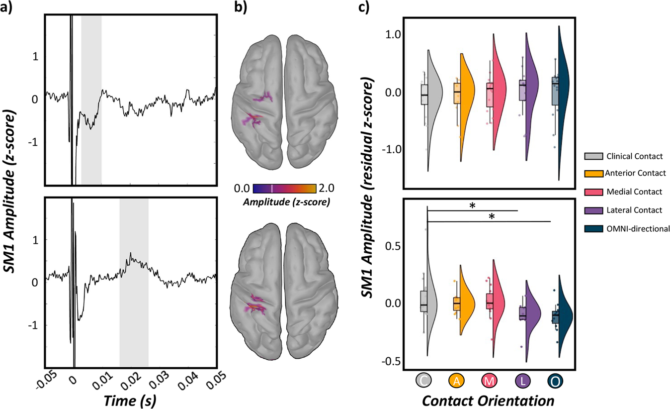 DBS-evoked cortical responses index optimal contact orientations and motor outcomes in Parkinson’s disease