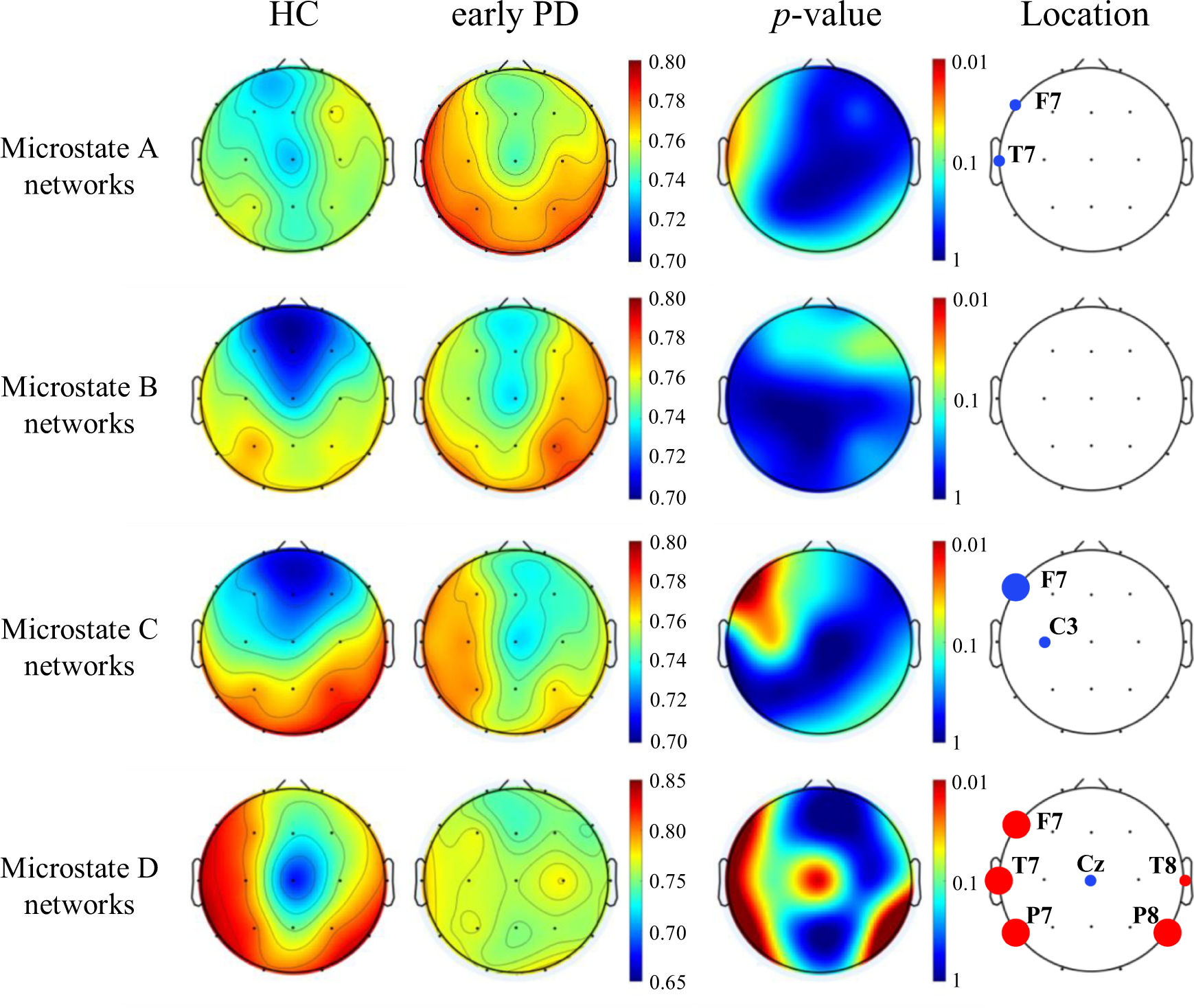 Fig. 3: Topological distribution of spatial variability of microstate functional connectivity networks (averaged over the subjects) for both groups and their differences in the four-microstate networks.