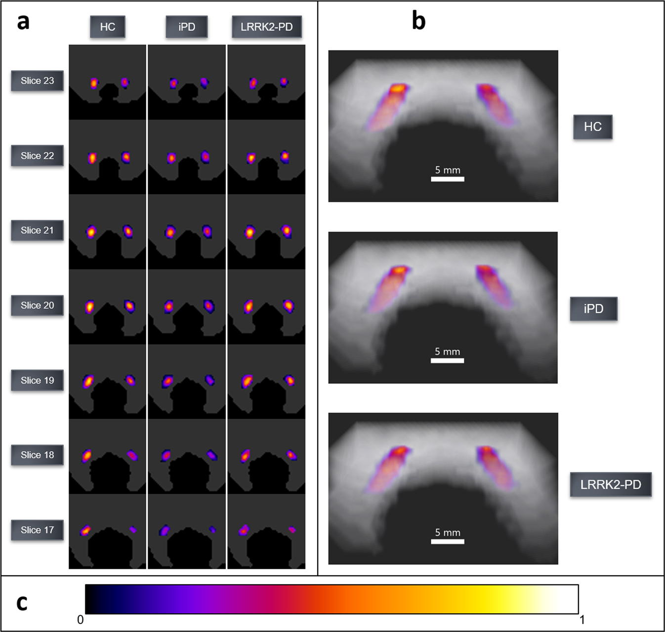 Fig. 5: Probabilistic maps of the LC NM content in HC, iPD, and LRRK2-PD groups.