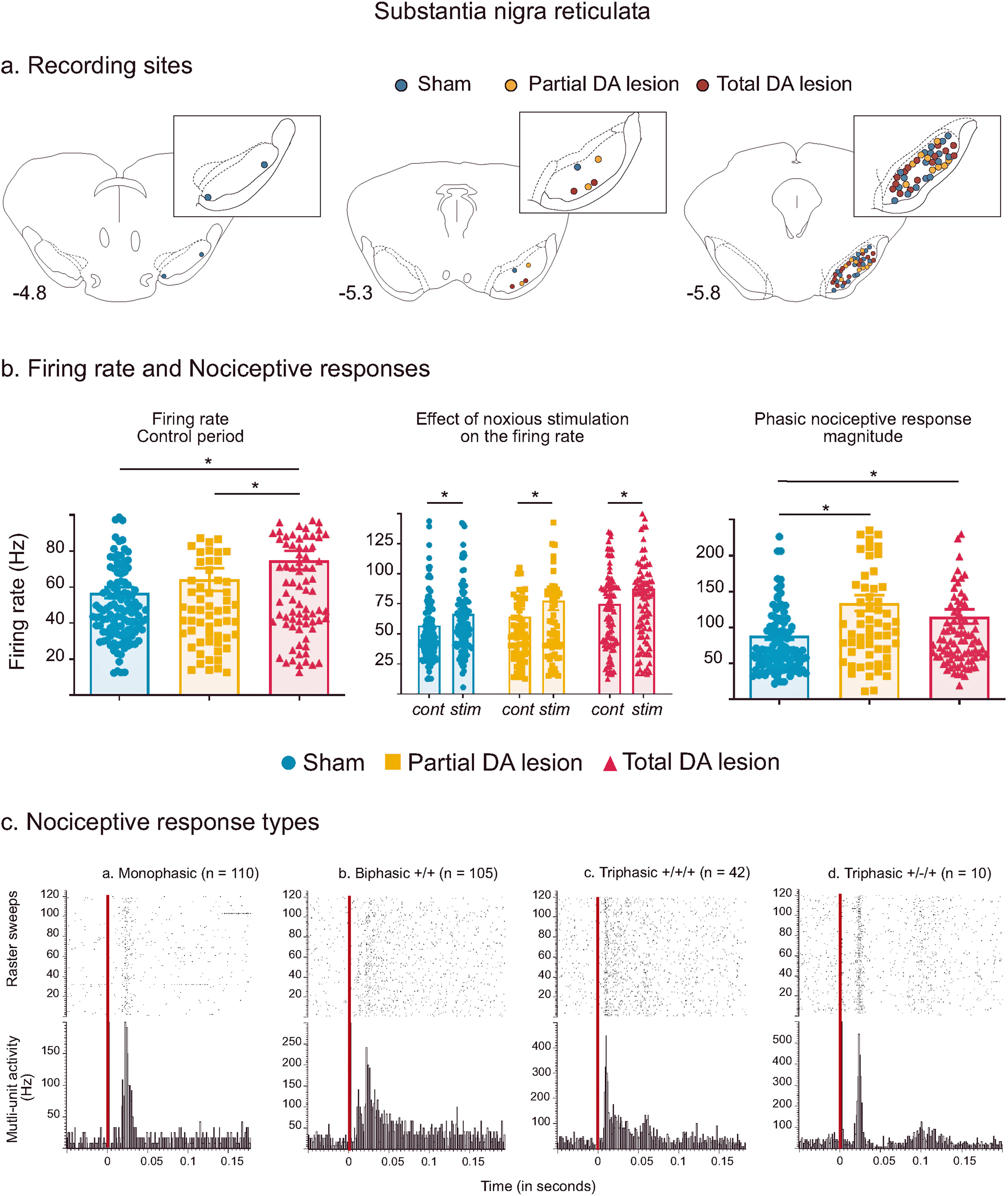 Fig. 2: Subtstantia nigra pars reticulata histological and electrophysiological results.