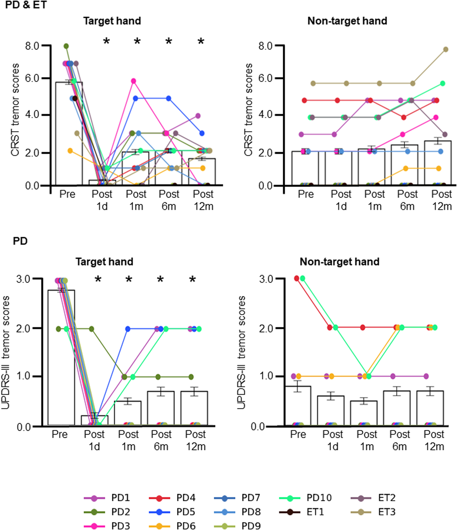 Fig. 3: MRgFUS successfully alleviated tremor in the target hand.