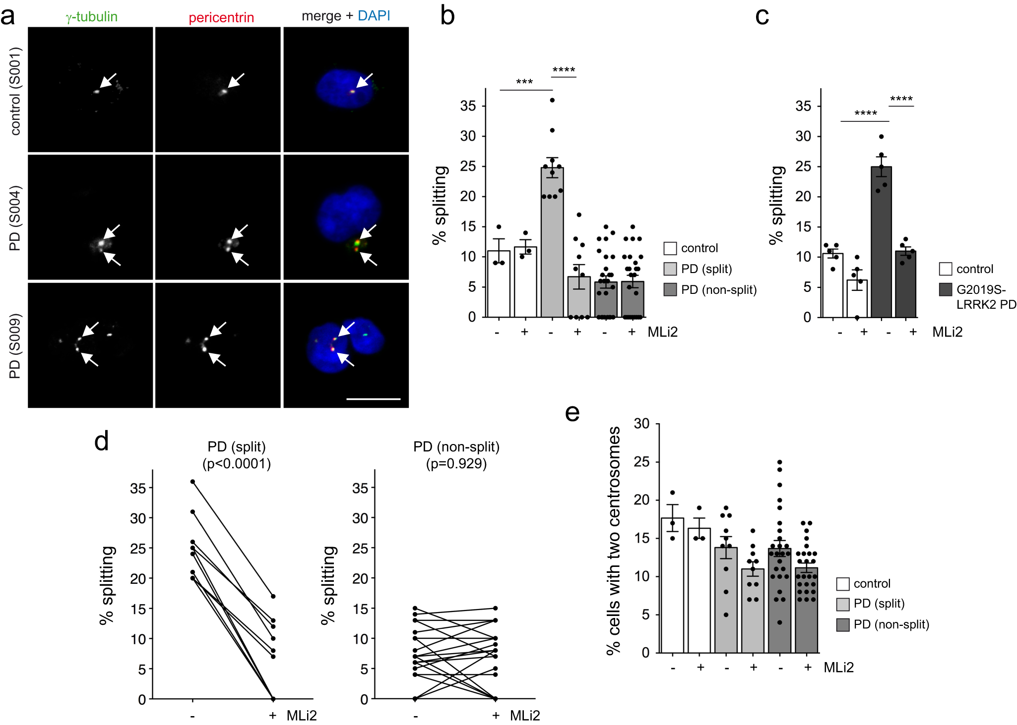 Fig. 1: A subset of PD patient LCLs display centrosomal cohesion deficits reverted by short-term treatment with the LRRK2 kinase inhibitor MLi2.