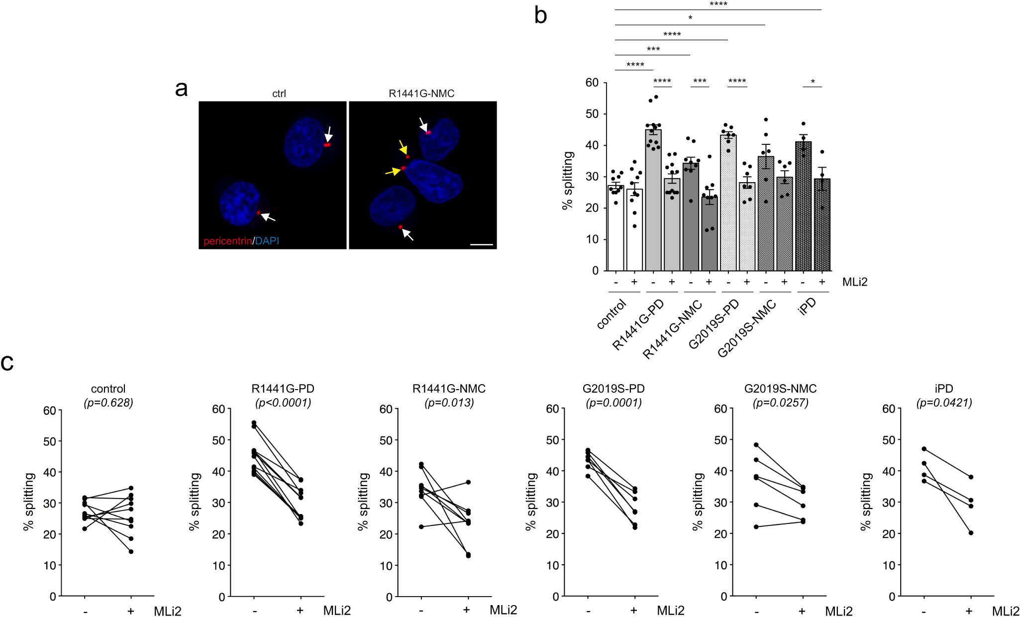Fig. 4: C/C cohesion deficits in R1441G-LRRK2 and G2019S-LRRK2 LCLs.