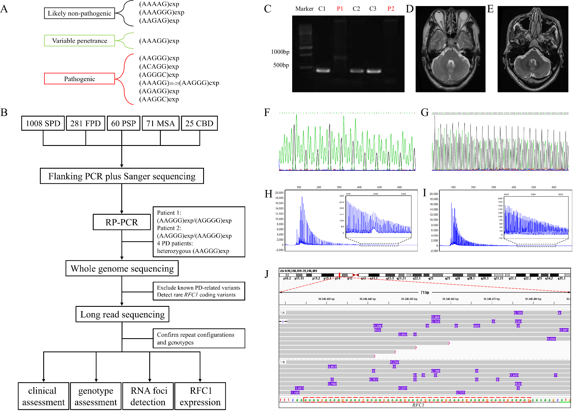 Fig. 1: Repeat expansion motifs at RFC1 locus, flow chart, and result of genetic investigations and MRI scan.