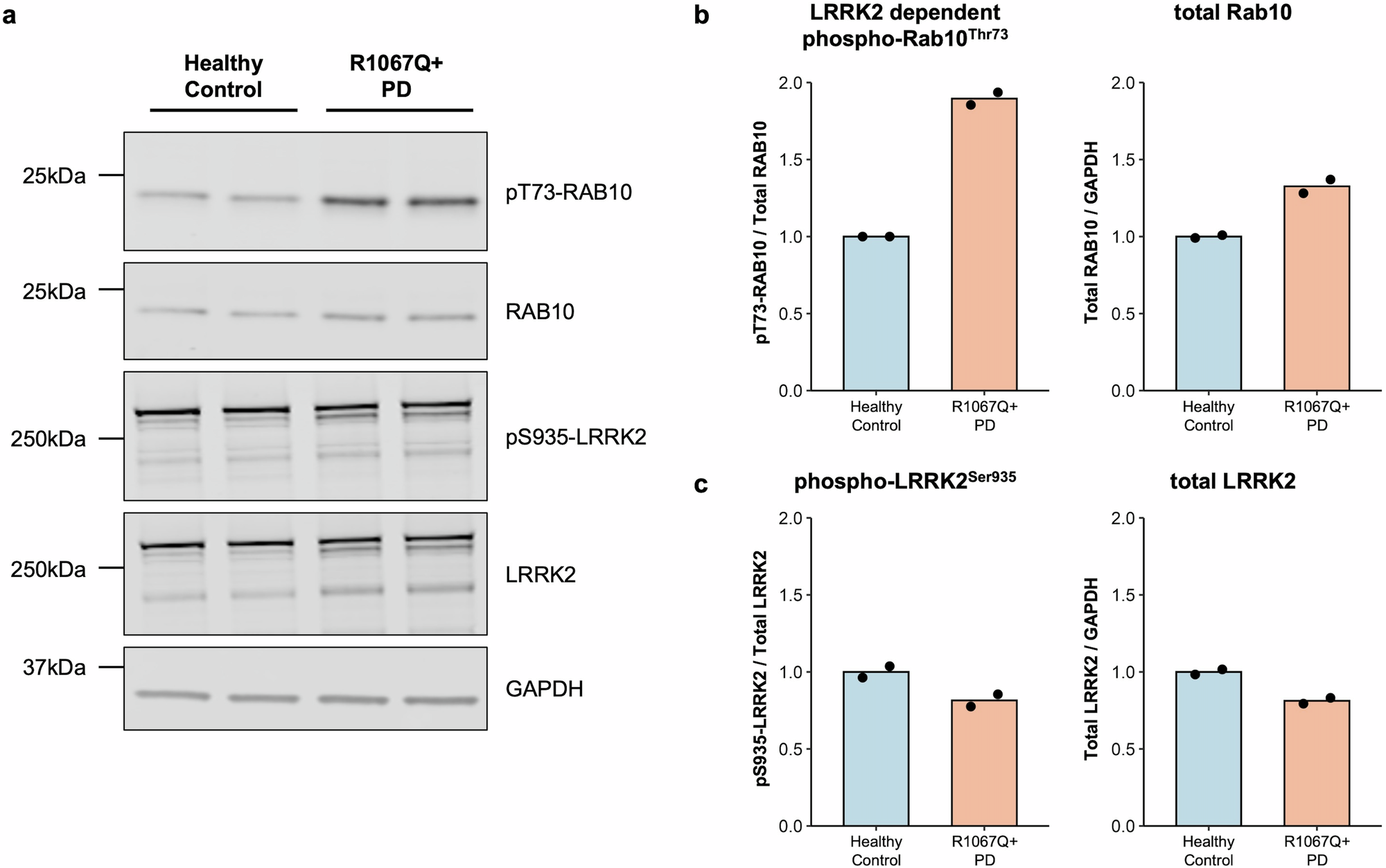 Fig. 2: LRRK2 kinase hyperactivity in vivo due to the presence of the LRRK2 p.Arg1067Gln (p.R1067Q) variant.