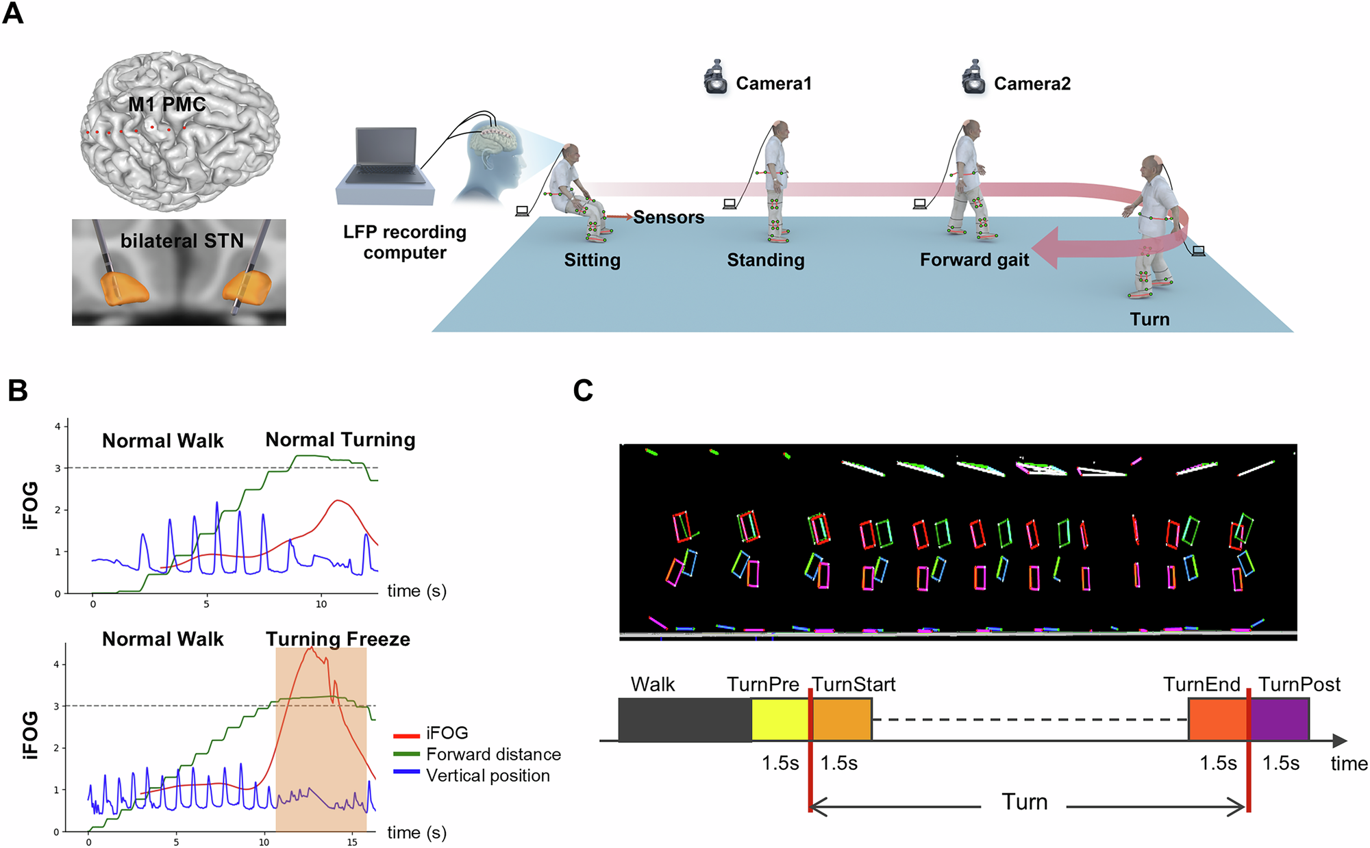 Neural signatures of turn-induced freezing of gait in Parkinson's disease: insights from phase-specific cortico-subthalamic dynamics