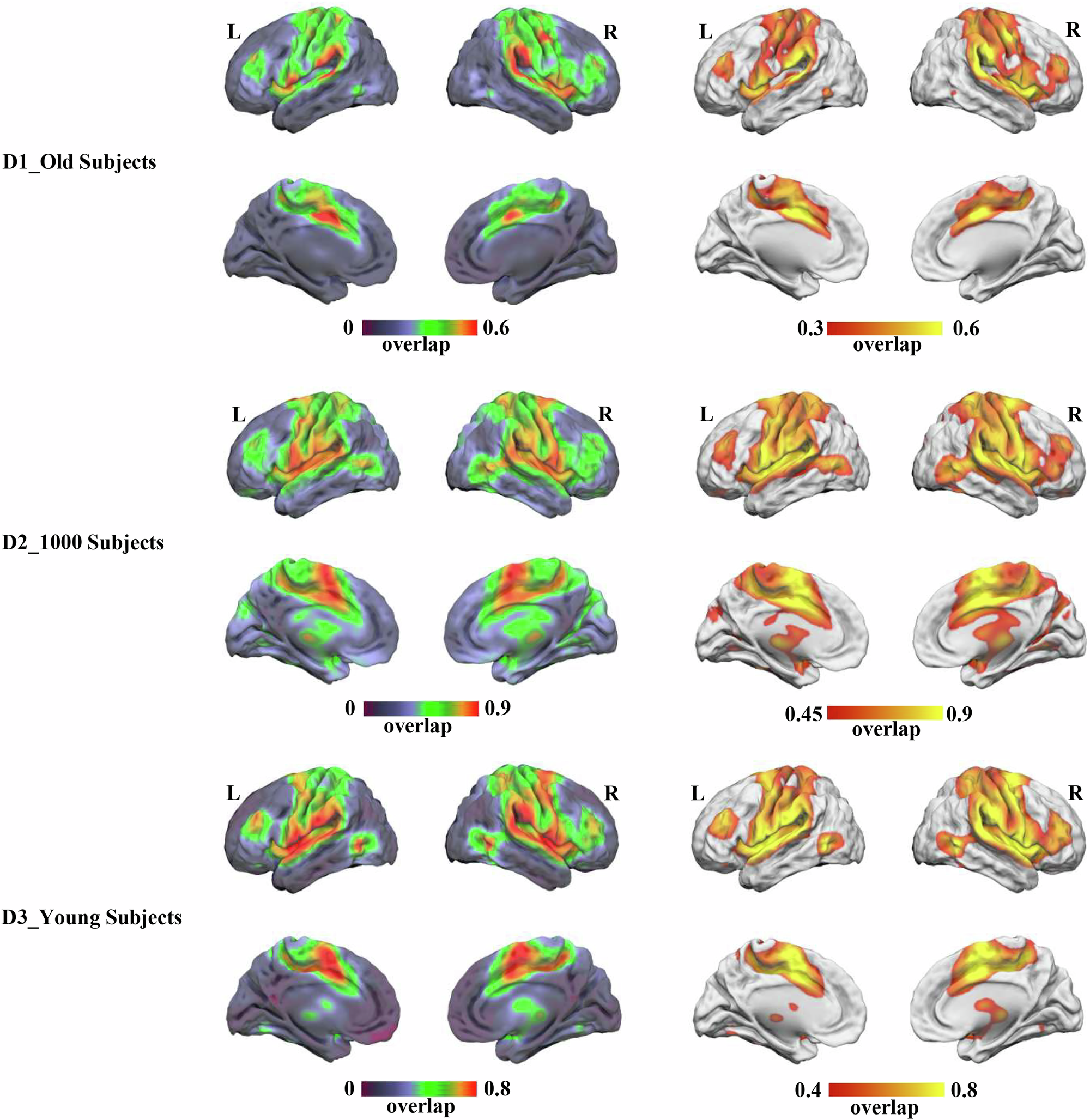 Fig. 2: The “fatigue-related network” in PD identified by integrating the ALE meta-analysis and ANM technique.