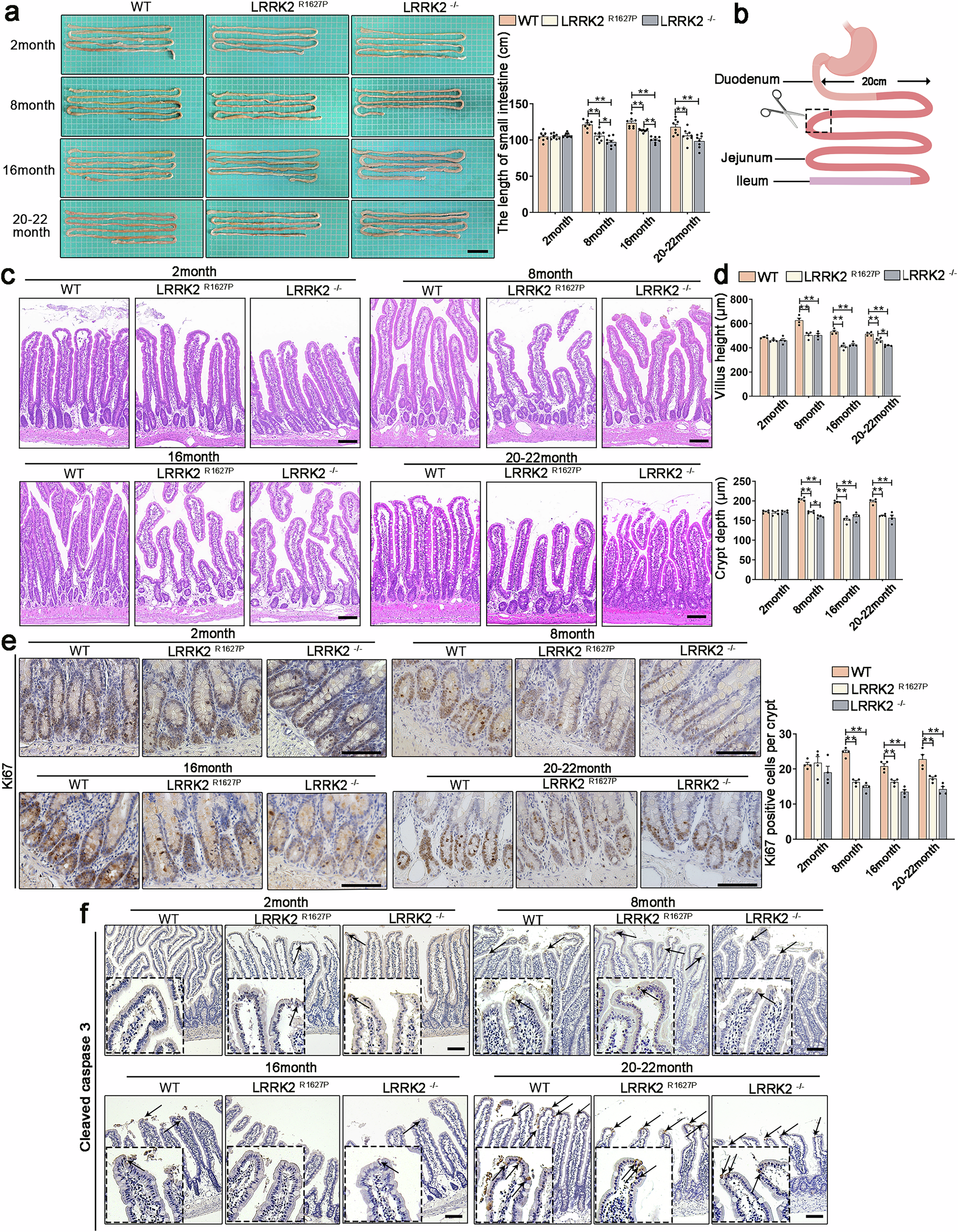Fig. 2: Intestinal pathological phenotypes of WT, LRRK2R1627P and LRRK2−/− rats at different ages.