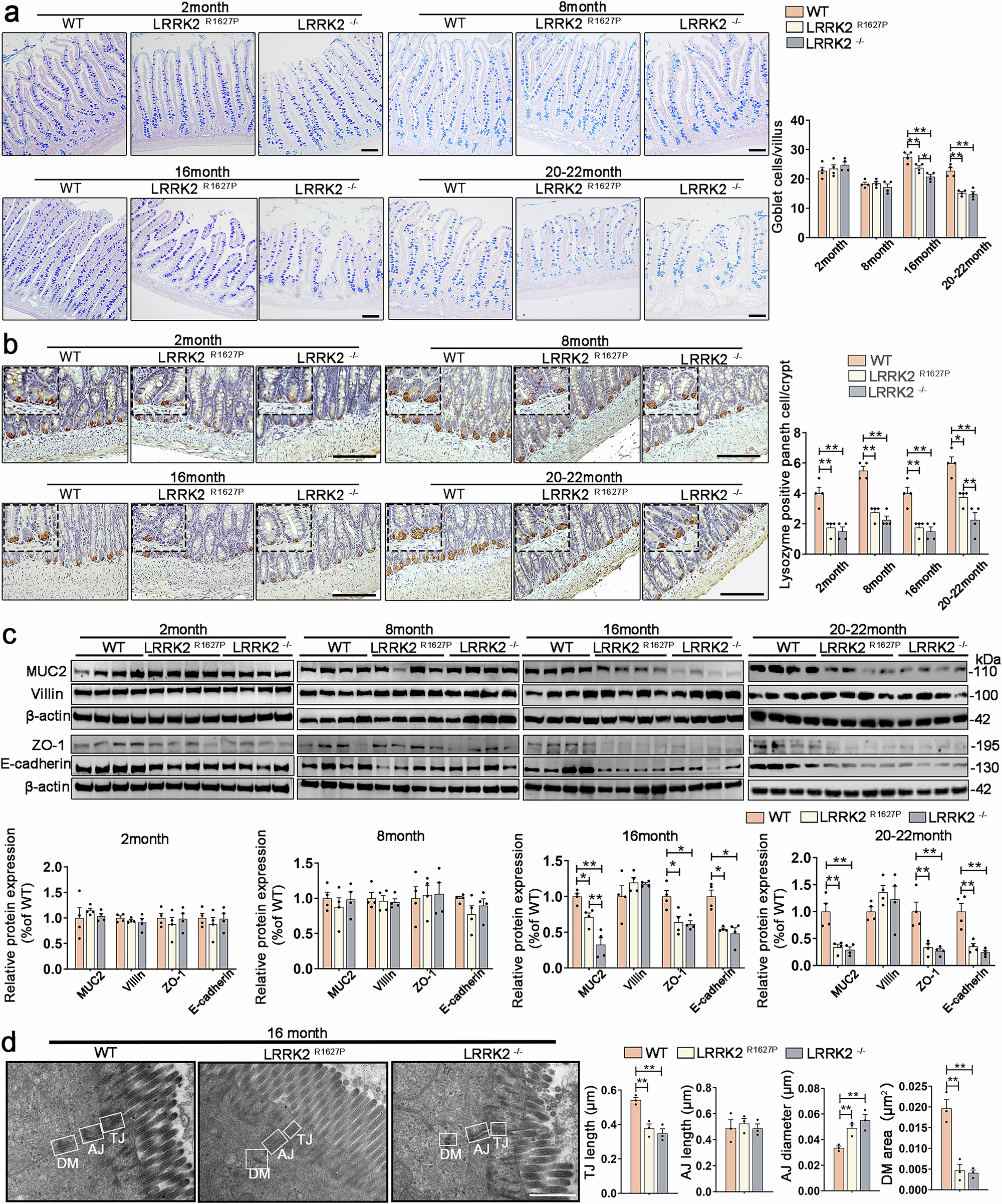 Fig. 3: Differentiation and intercellular junctions of small intestinal epithelial cells in rats at different ages.