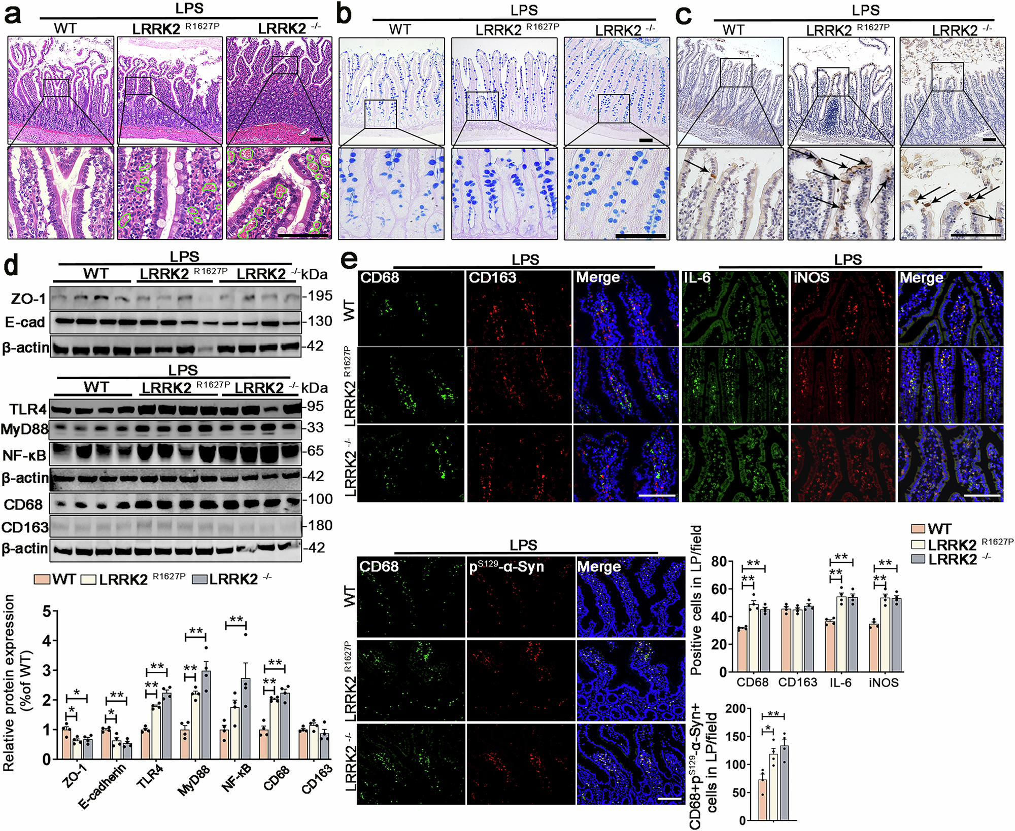 Fig. 5: Effect of intraperitoneal injection of LPS on rat small intestine after 6 h.