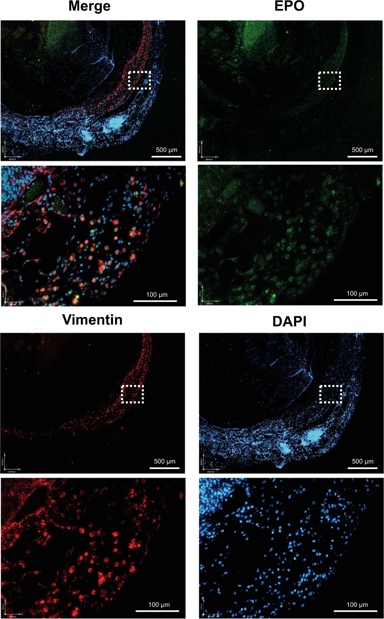 Fig. 5: Immunofluorescent staining of EPO-TVC explant.