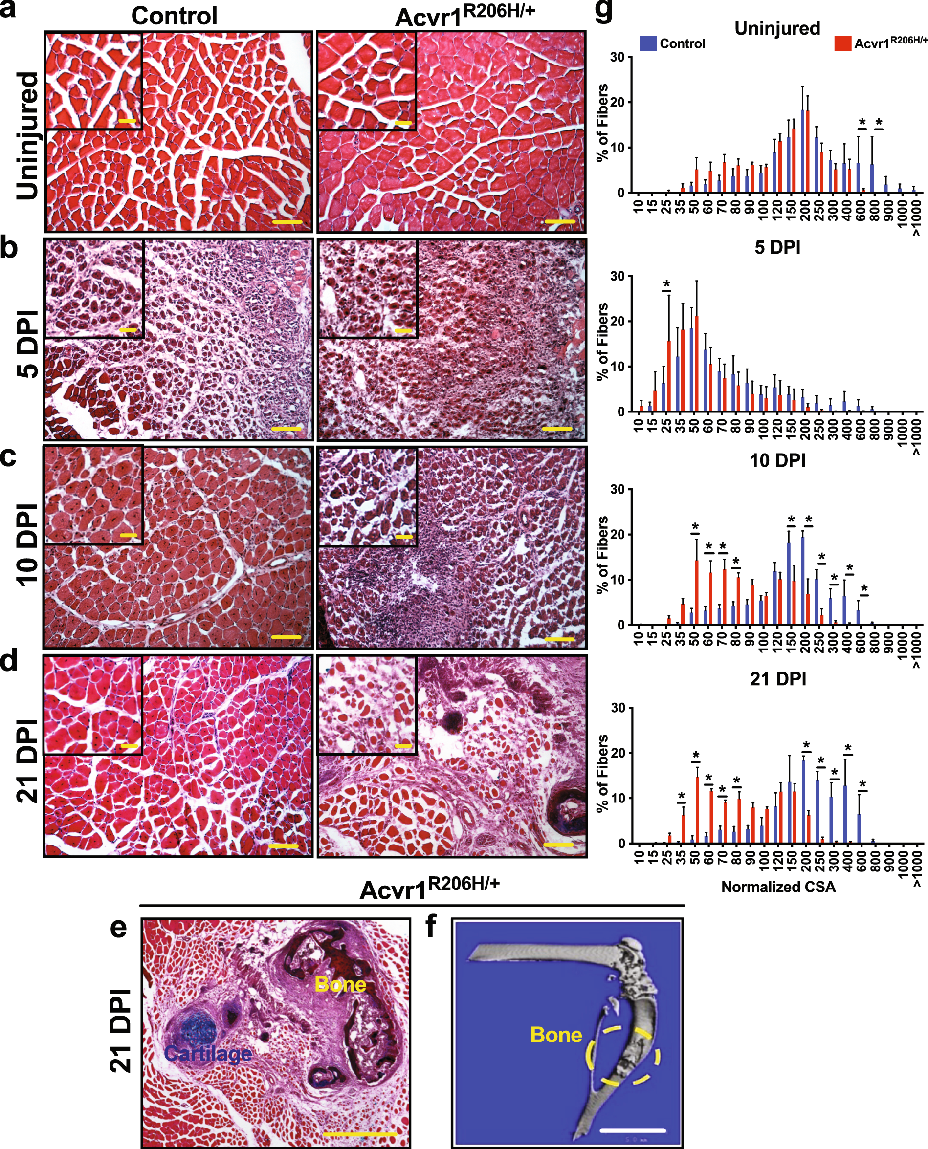 Dynamics of skeletal muscle-resident stem cells during myogenesis in fibrodysplasia ossificans progressiva npj Regenerative Medicine