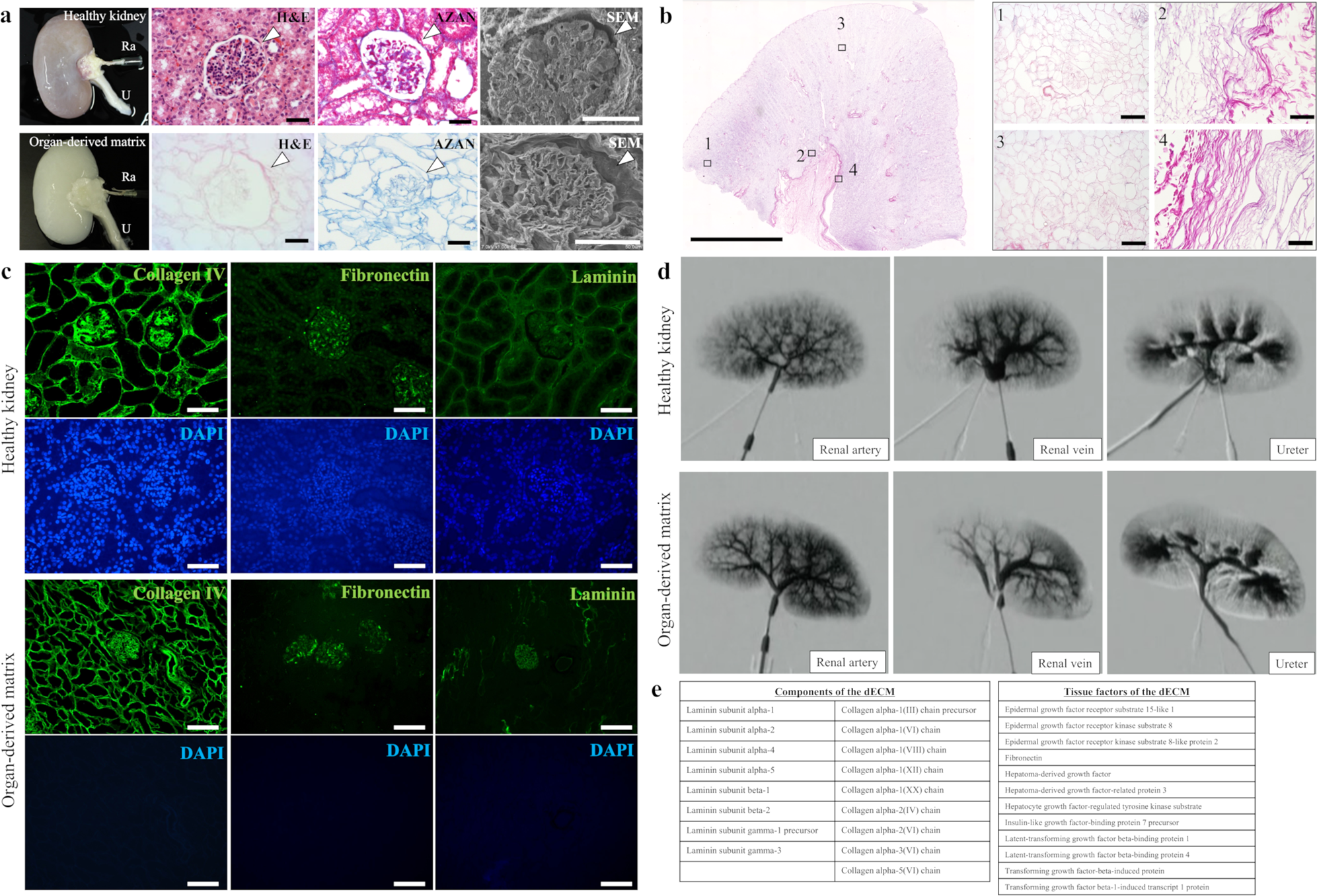 An organ-derived extracellular matrix triggers in situ kidney regeneration  in a preclinical model | npj Regenerative Medicine